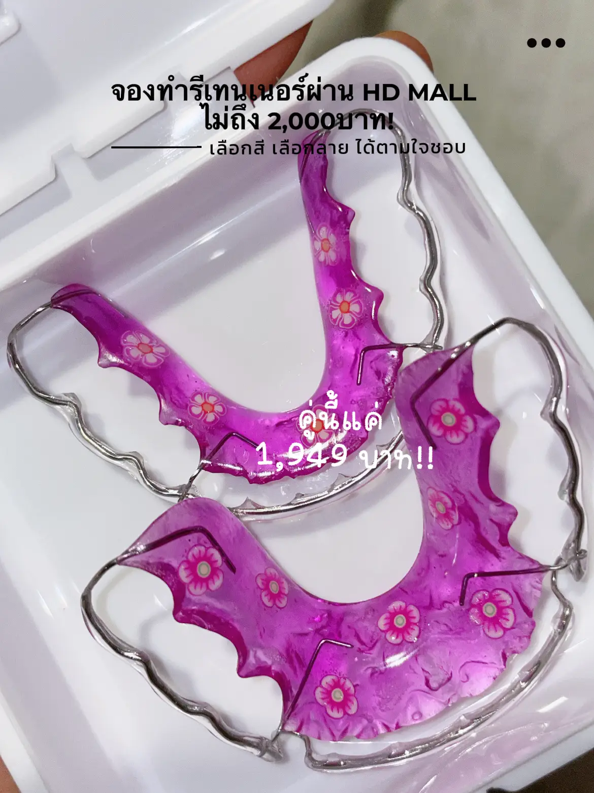 Book A Retainer Through HD Mall For Less Than 2 000 Baht Gallery book-a-retainer-through-hd-mall-for-less-than-2-000-baht-gallery