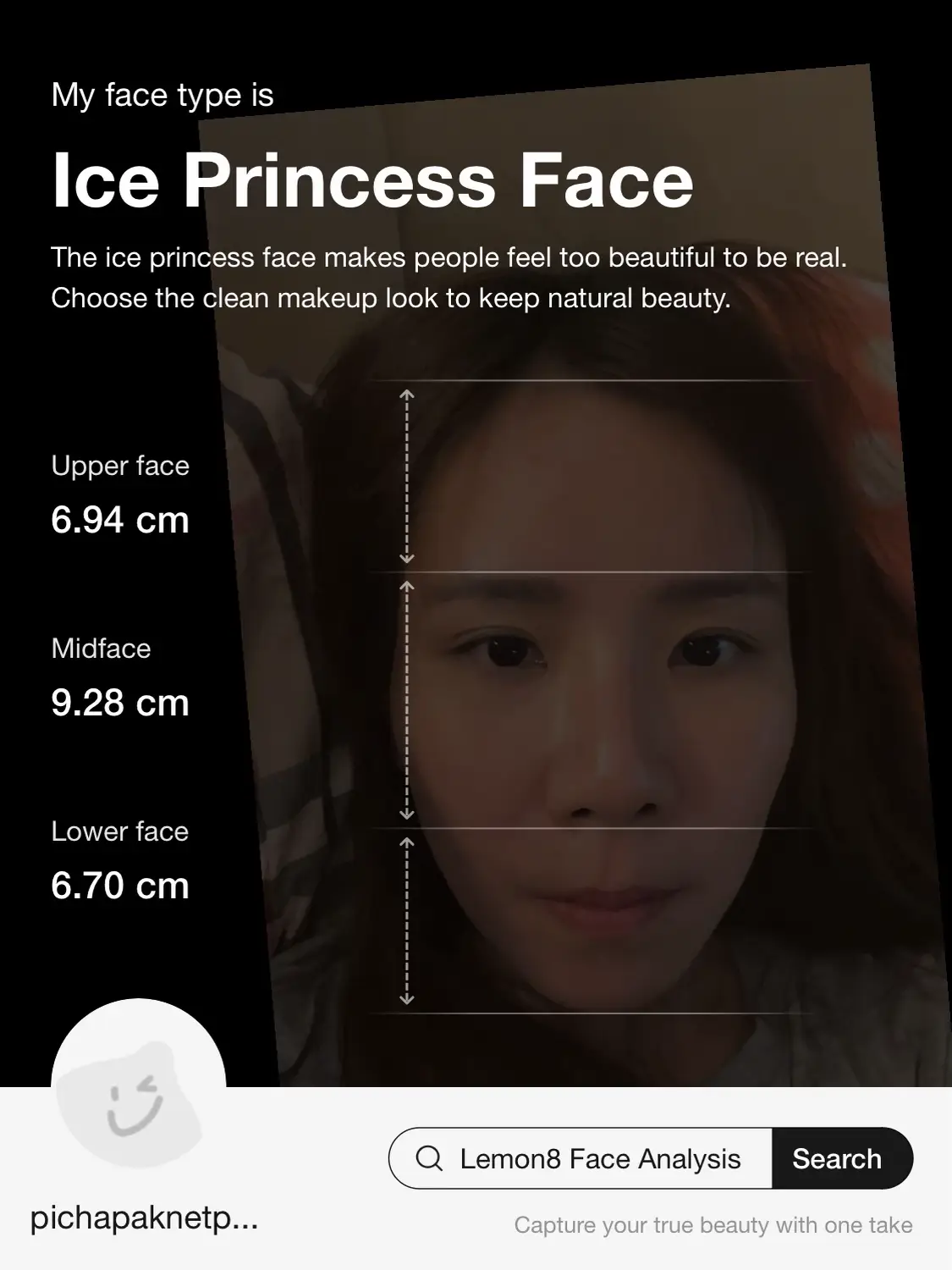 My Face Analysis Report แกลเลอรีที่โพสต์โดย Pichapak Netpra Lemon8
