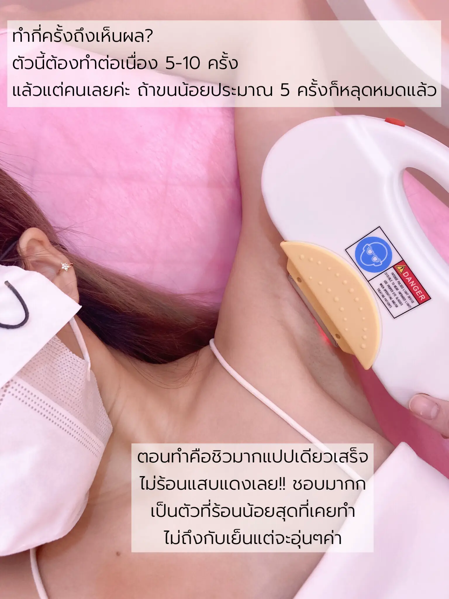 Cold AFT Hair Laser Hair Removal to Root Non Burning Skin