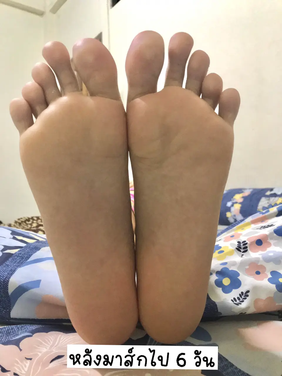 Turning Old Foot Into New Foot With Baby Foot | Gallery posted by  namnamthip | Lemon8