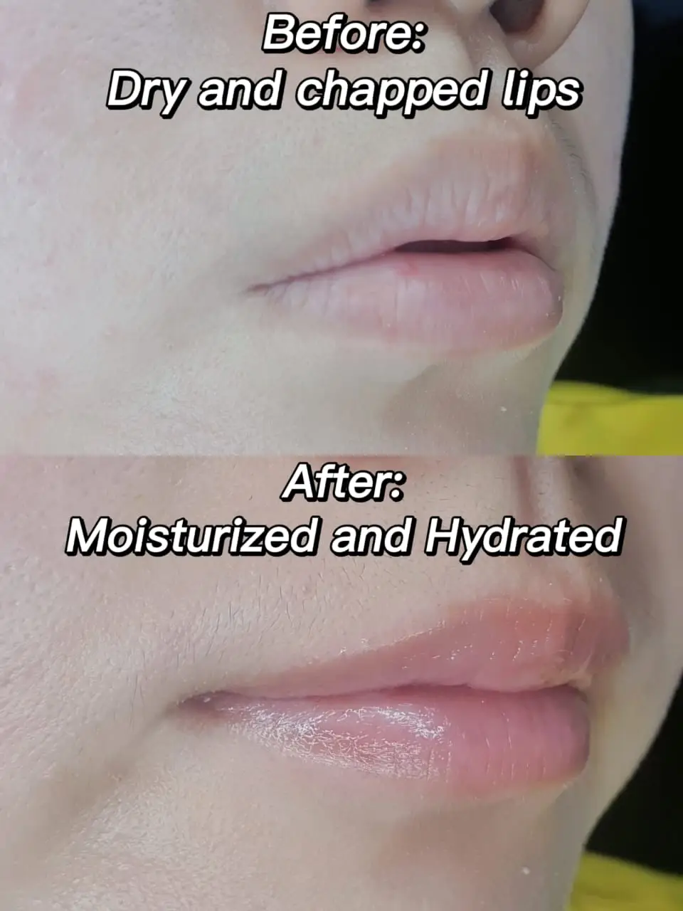 💫Affordable Lip Balm for Dry Lips💙 แกลเลอรีที่โพสต์โดย Carrotlobak