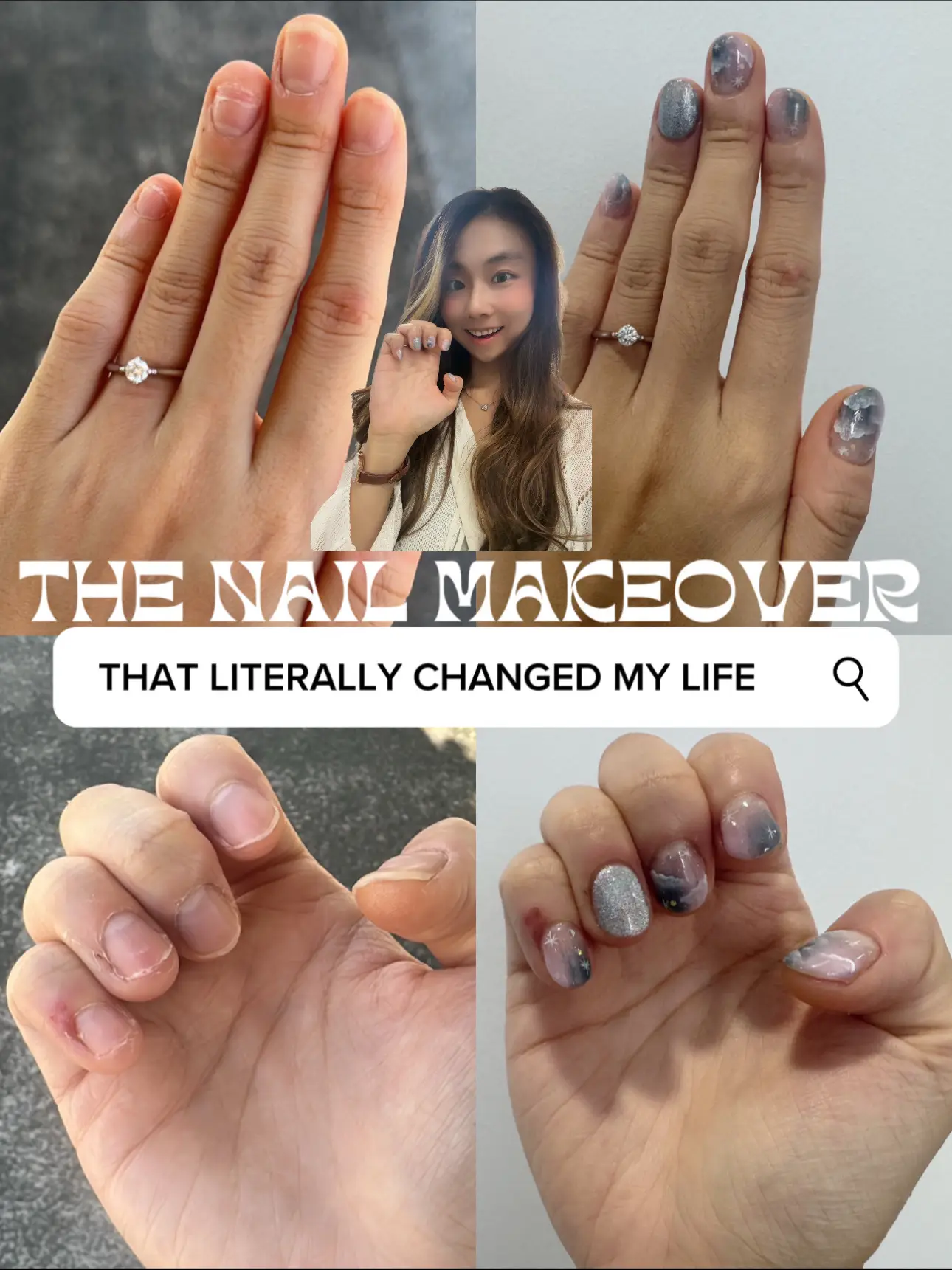 I wanted to stop biting my nails after being 💍, Gallery posted by Denise  Tan