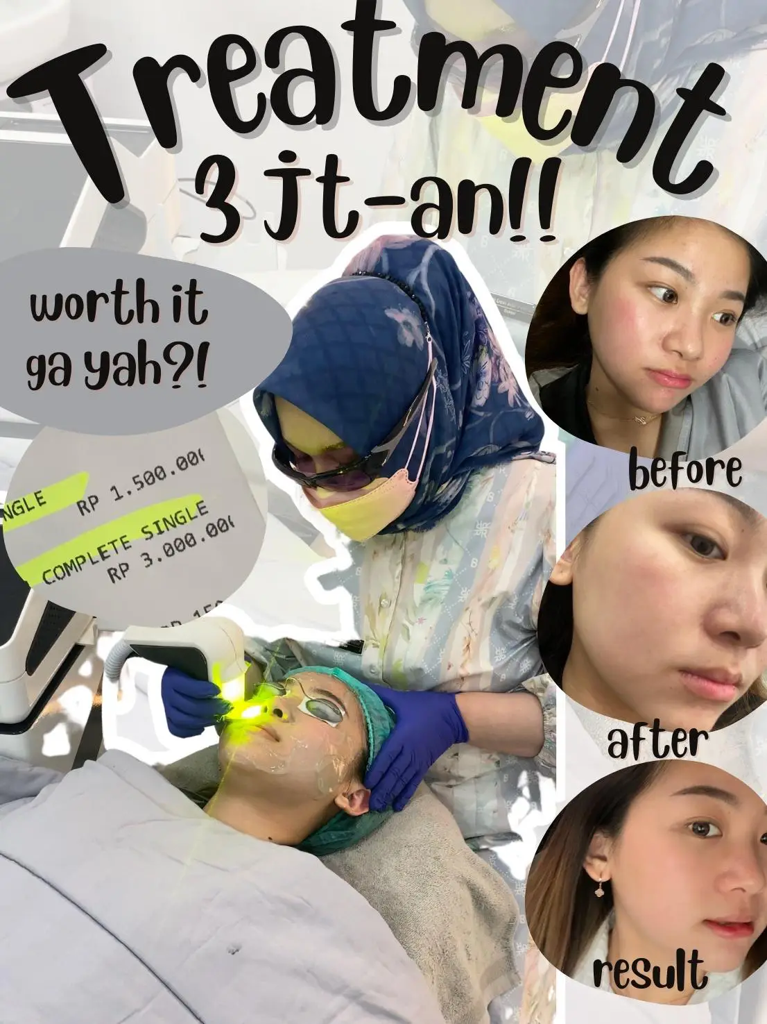 TREATMENT LASER PRO YELLOW 3JT-AN?!! WORTH IT?! | Galeri diposting oleh ...
