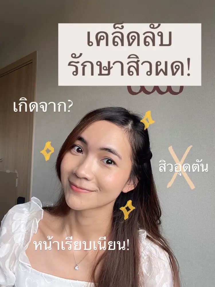 เคล็ดลับกำจัดสิวผด!! | แกลเลอรีที่โพสต์โดย namfonka | Lemon8