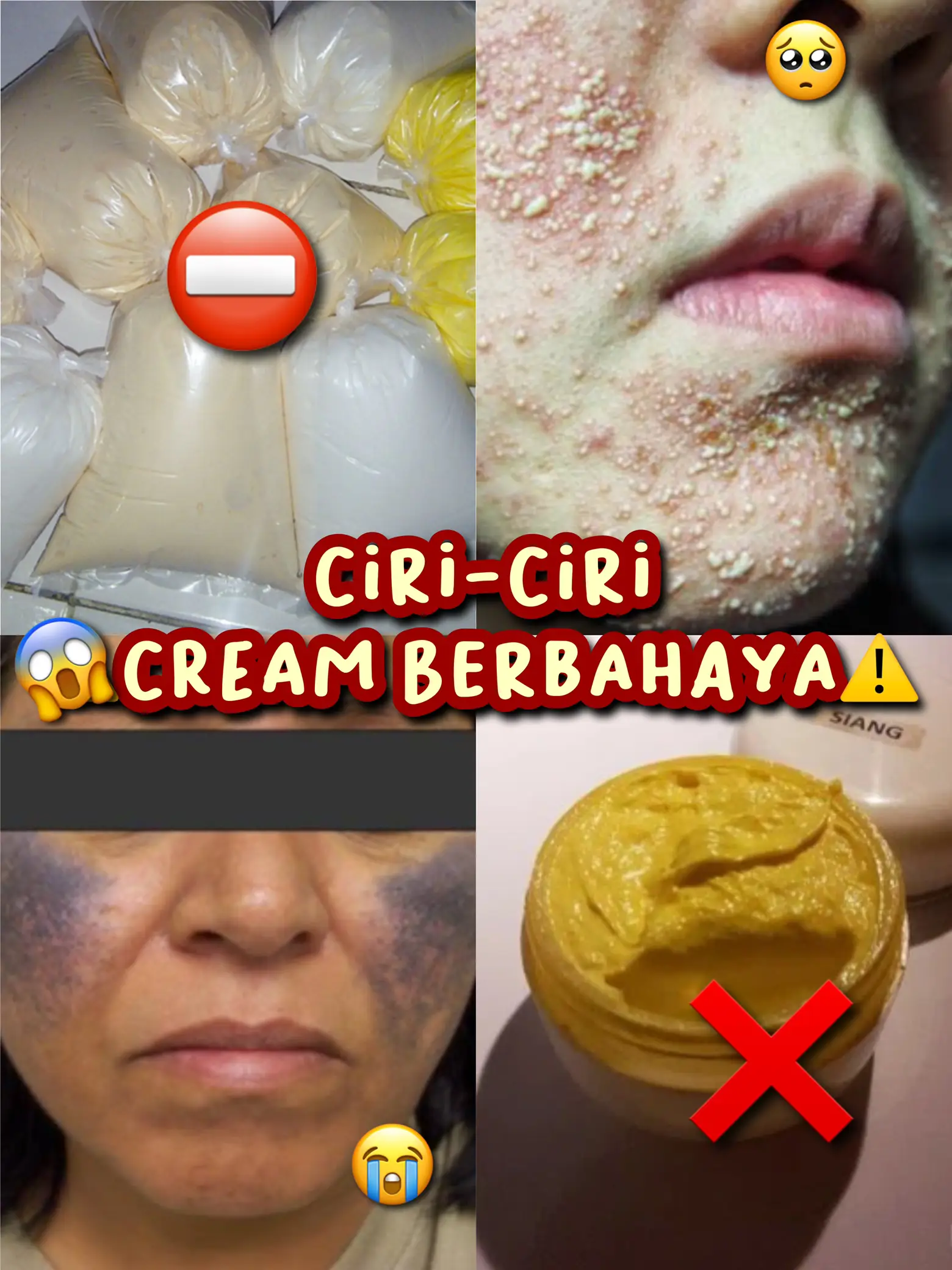 Achromin Cream Review Carian Lemon8