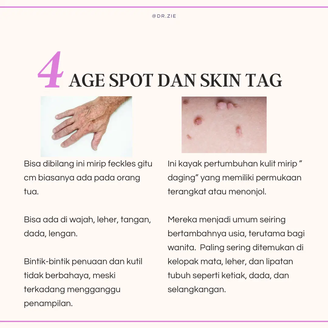 Problem kulit “ORANG TUA” | Gallery posted by dr.zie | Lemon8