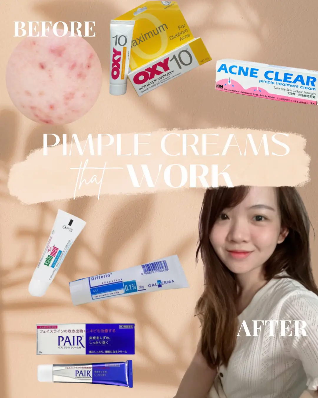 Pimple Creams That WORKS 🥹✨'s images(1)