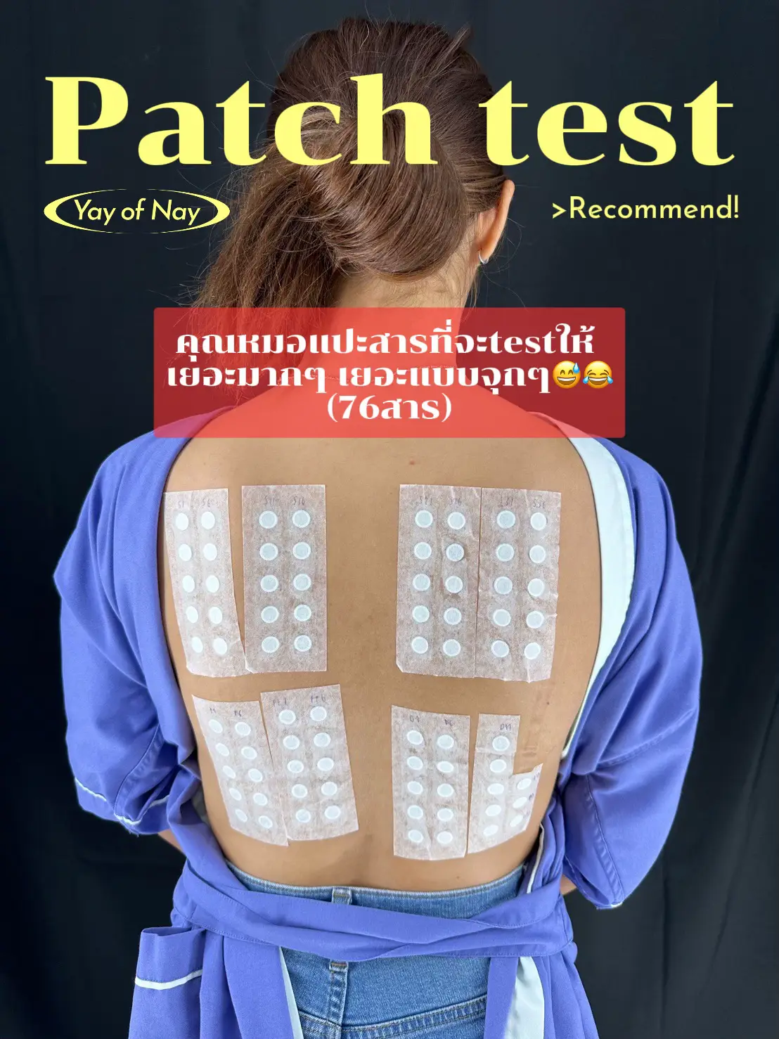 Patch test กับคนแพ้ลิปสติกแบบเรา | แกลเลอรีที่โพสต์โดย แอปปาเลิ่น | Lemon8