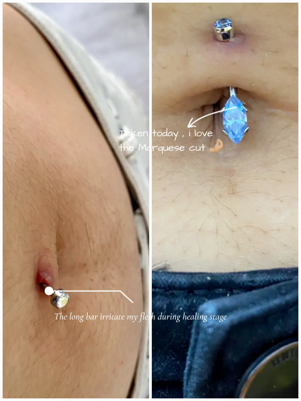 Healing stages of on sale a belly button piercing