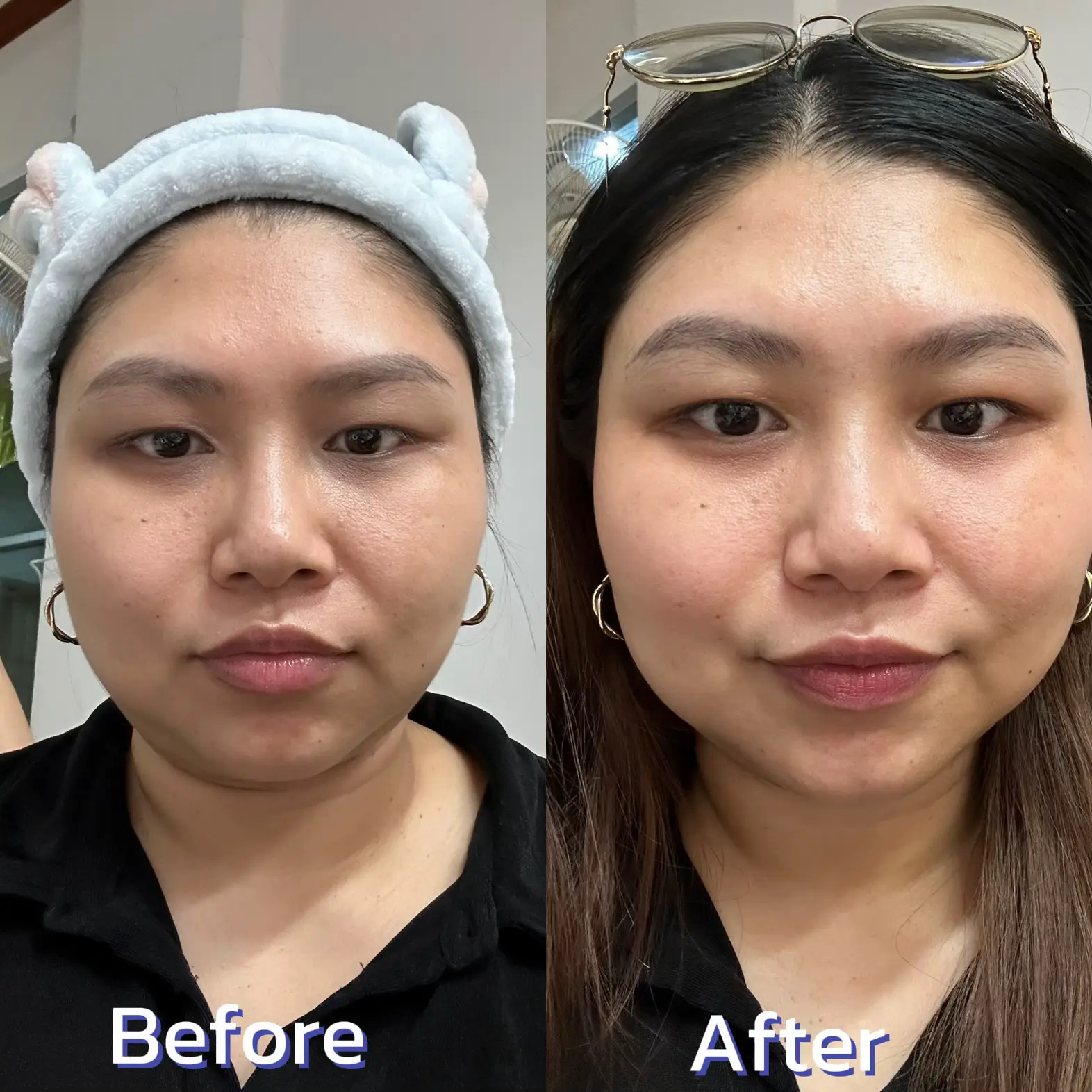 スキンケアで顔の輪郭を引き締めるテクニック｜必見！たるみ毛穴撃退の効率的マッサージ＆クリーム活用法