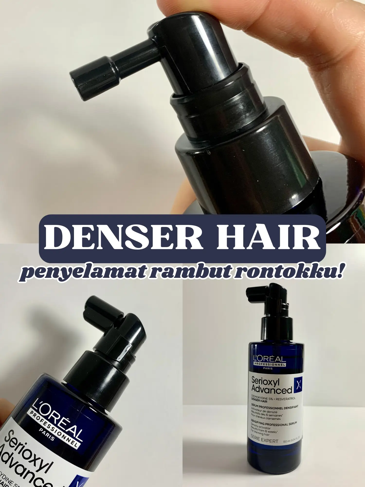 Best hair tonic for hair loss! ️‍🔥 Galeri diposting oleh Athaya