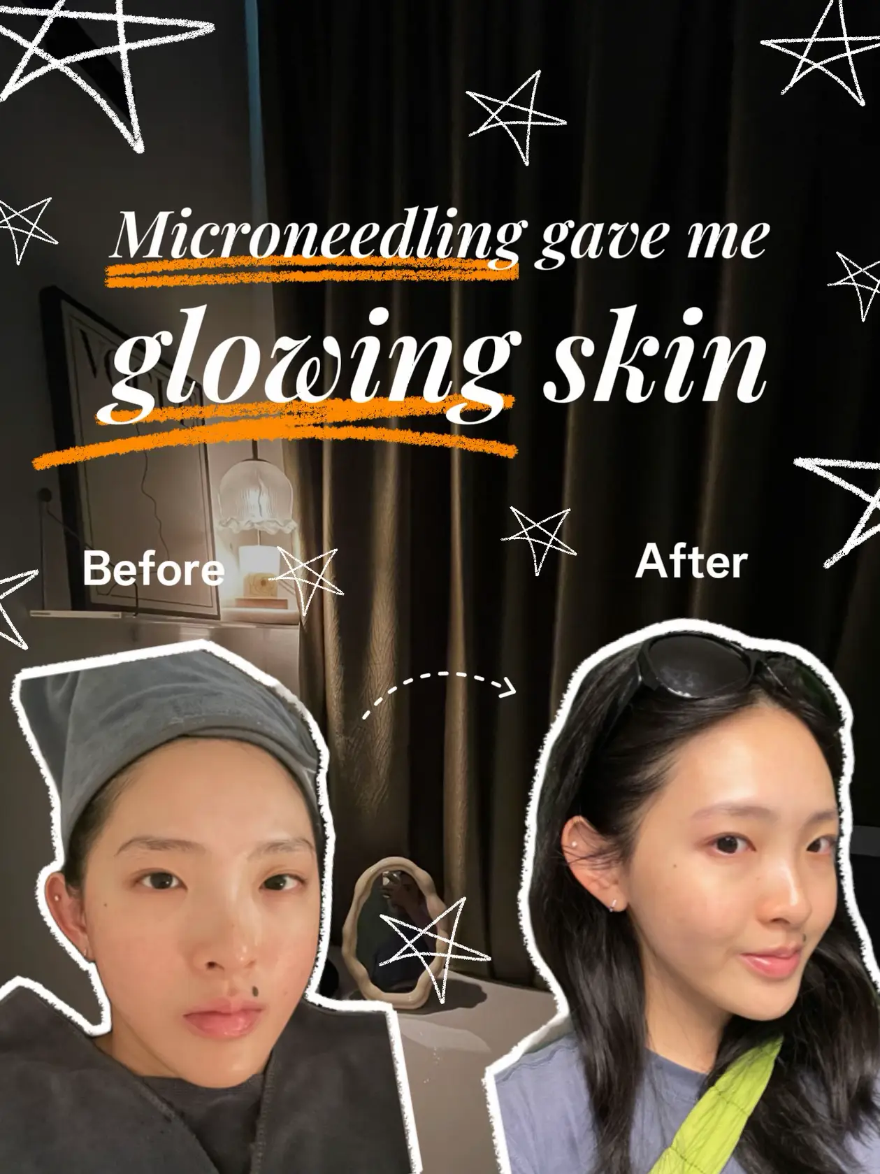 HOW TO SKIN PREP FOR CNY & NOSY RELATIVES 🤩🍯🧖‍♀️'s images