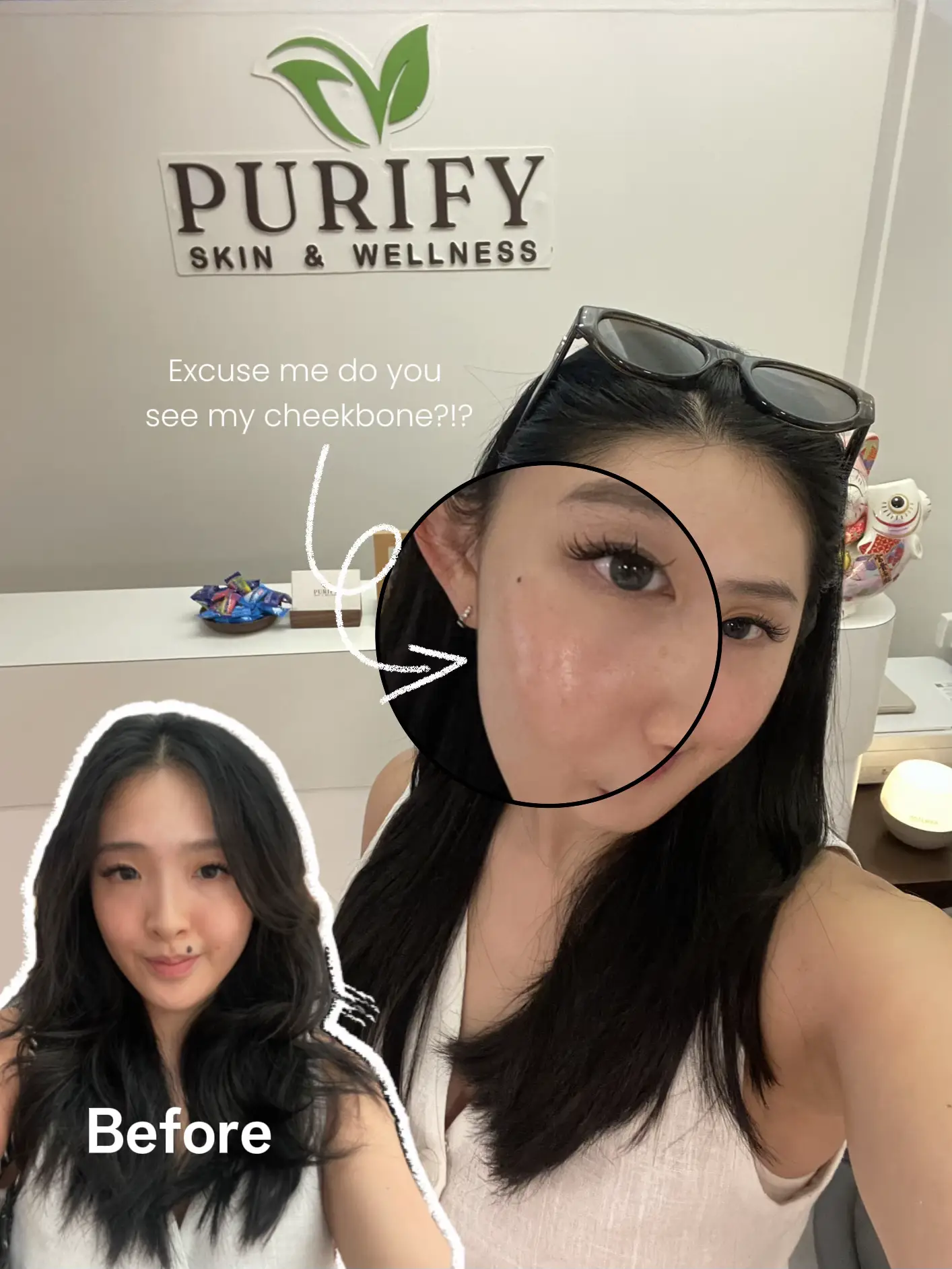 how-i-got-a-naturally-snatched-face-gallery-posted-by