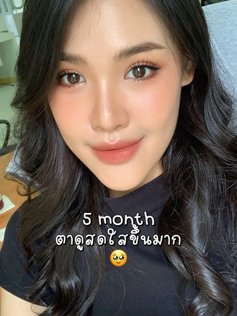 รีวิวศัลยกรรมตา 2 ชั้นแบบหวานกรุบ 👀 | แกลเลอรีที่โพสต์โดย Mymild | Lemon8