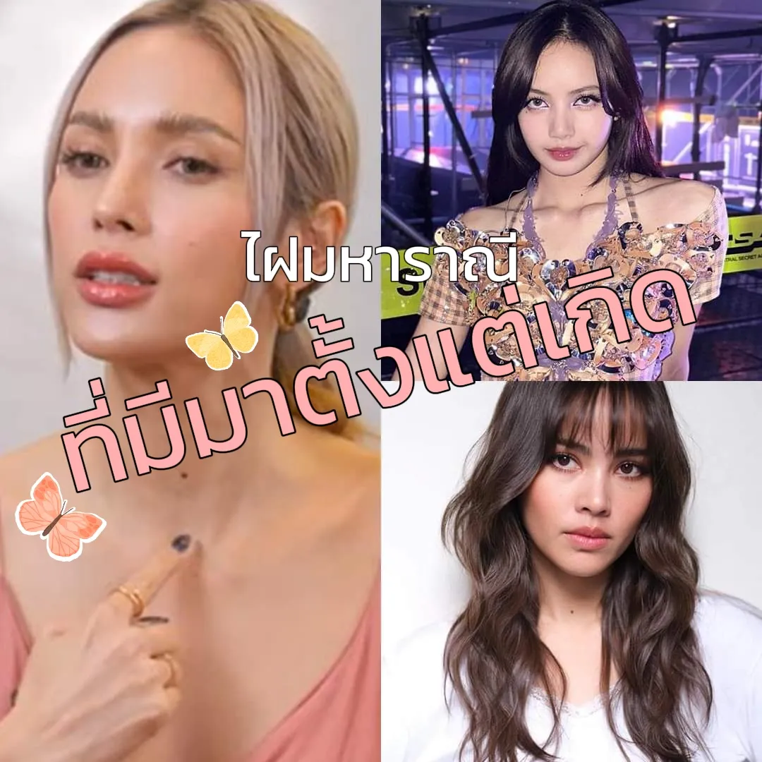 ไฝมหาราณี ขึ้นมาตอนฉัน 32 ขวบ | แกลเลอรีที่โพสต์โดย Ma riam | Lemon8