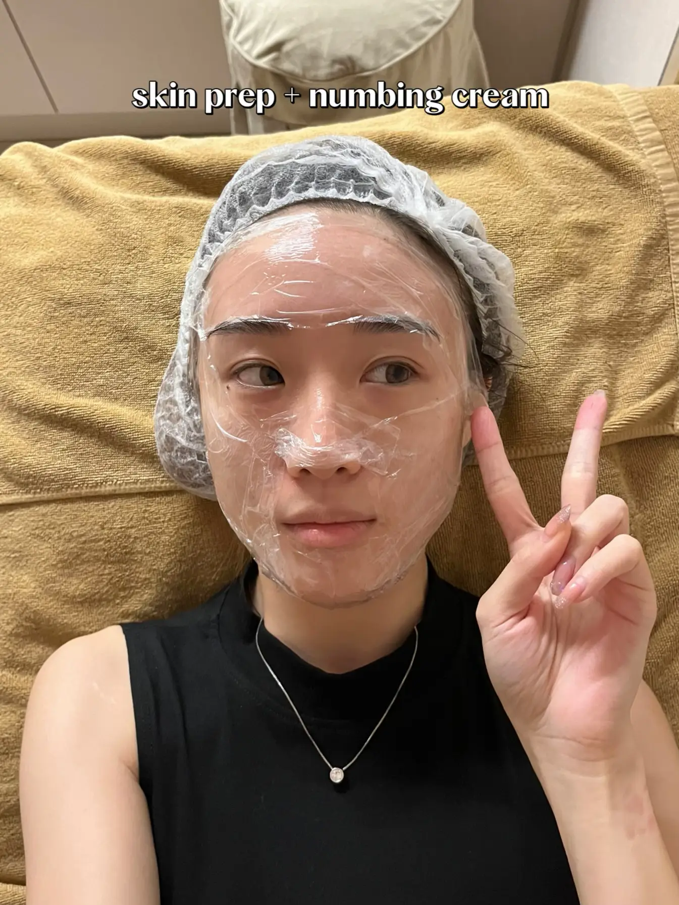 Pico Laser after 2 wks⚡️ Let’s talk skin treatments's images(3)