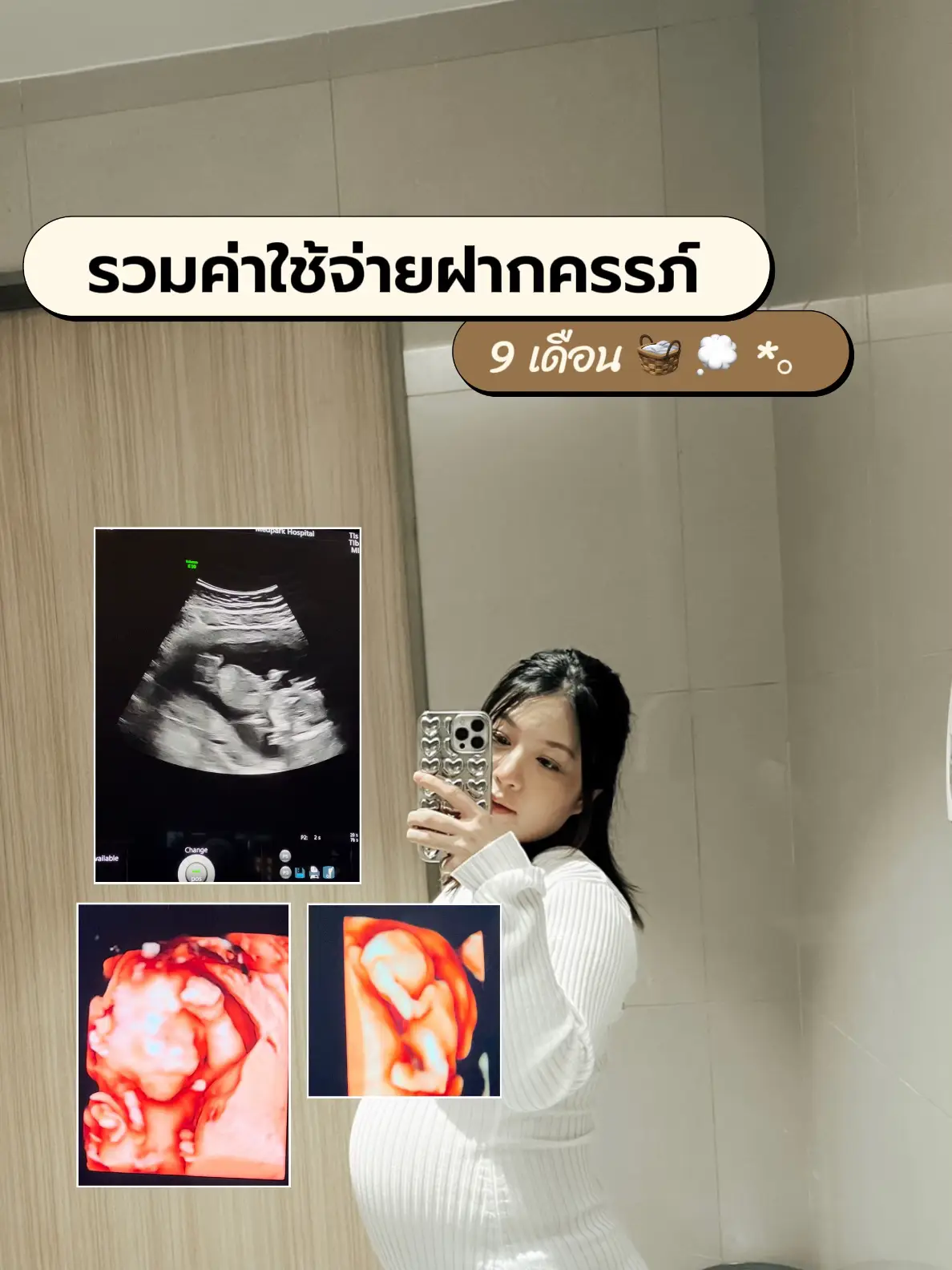 รวมค่าฝากครรภ์ รพ เอกชน แต่ละครั้งจ่ายเท่าไหร่ ꒱˚ ༘♡ แกลเลอรีที่โพสต์