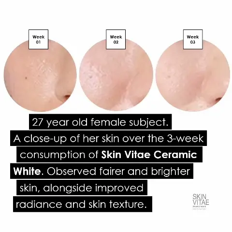 Visibly fairer skin in just 2 weeks!'s images