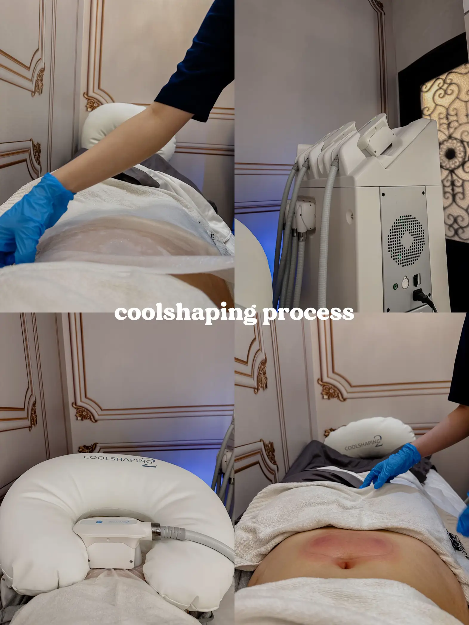 Freeze your fat away and reshape your body with our non-invasive fat  freezing and body reshaping treatment 🔥this revolutionary treatment…