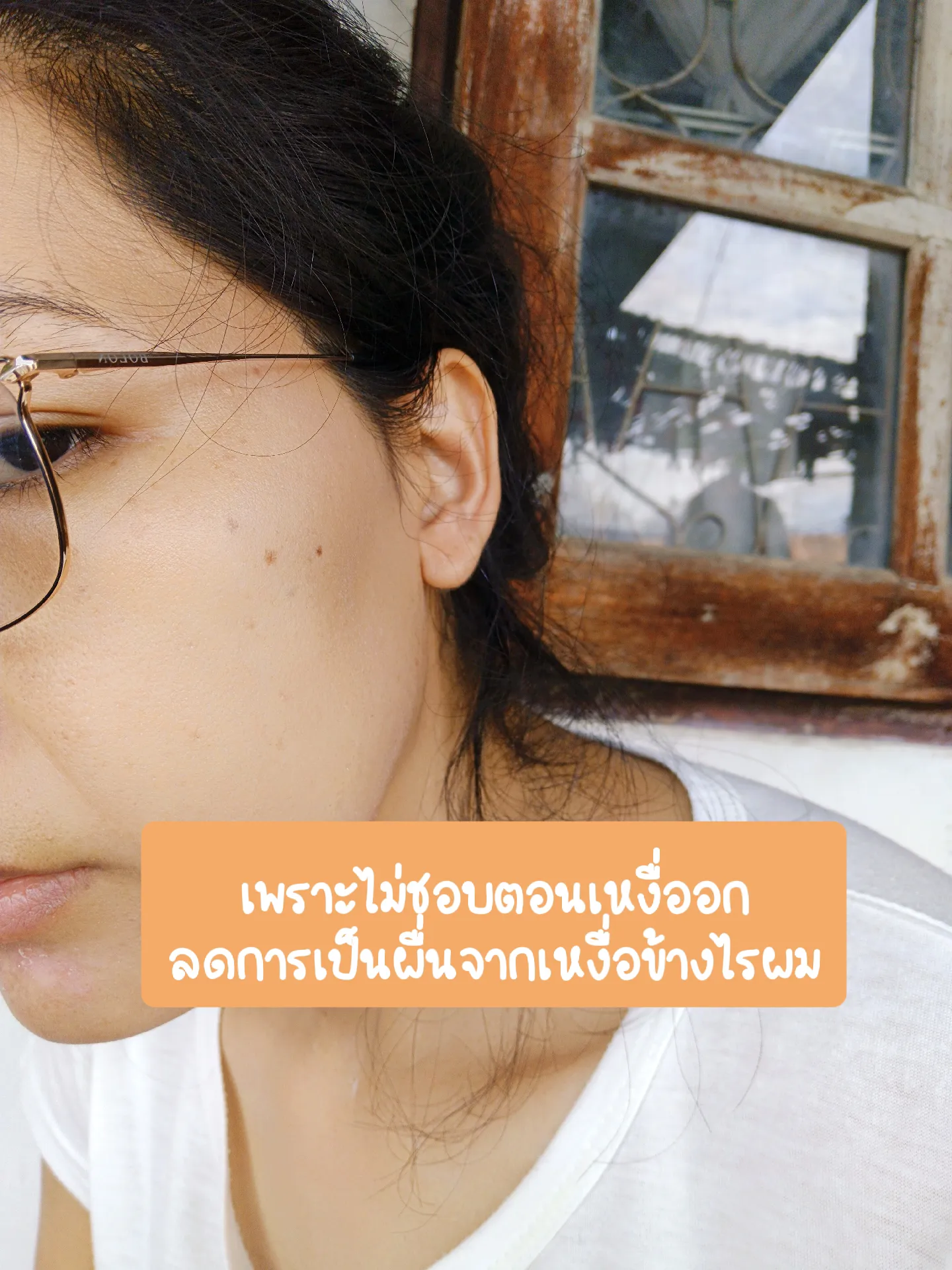 รีวิวกำจัดขนหน้าAPEXหลังทำ10ปี No spon🌸 | แกลเลอรีที่โพสต์โดย 😂KhunNut 