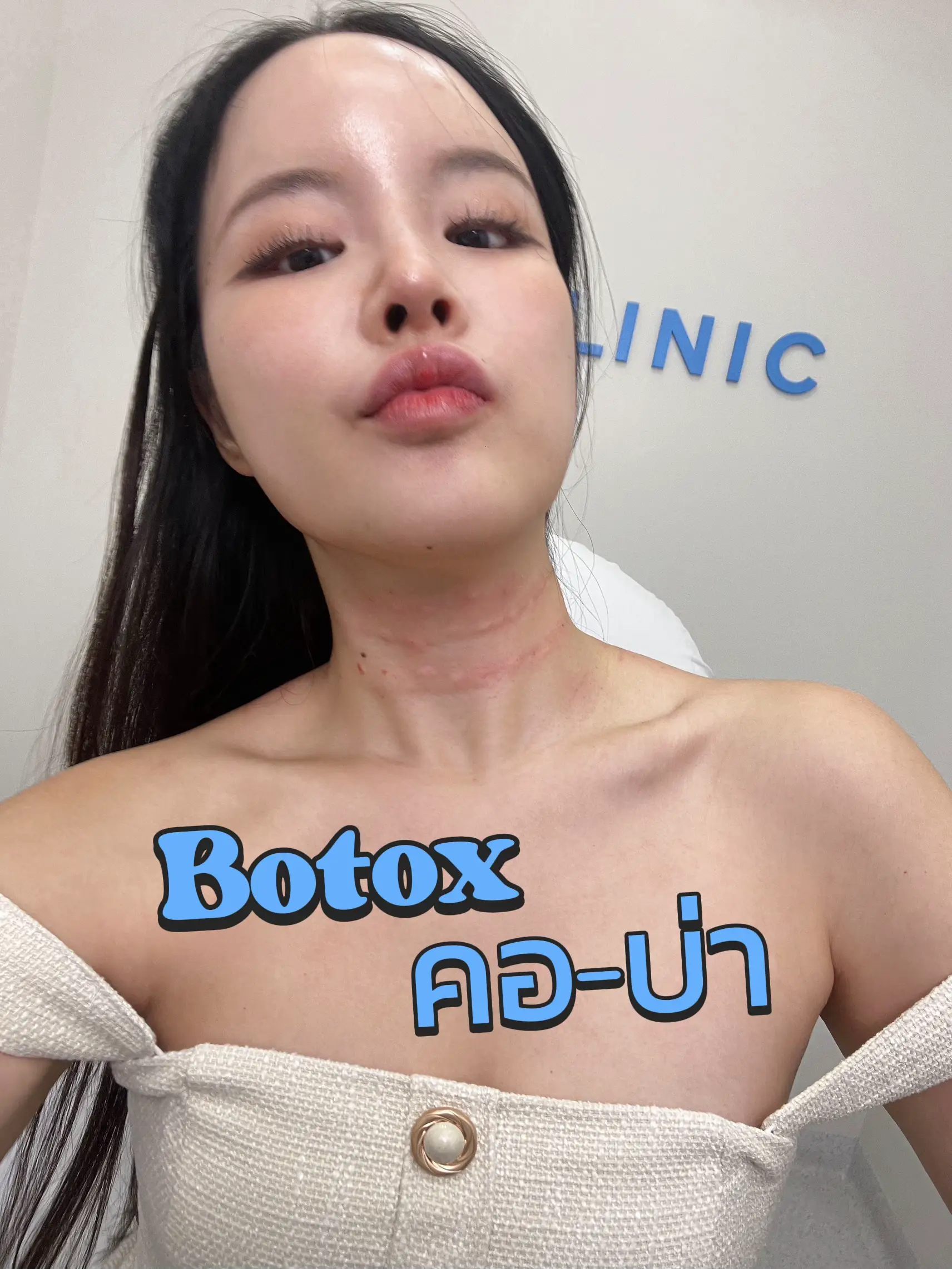 botox-office-syndrome