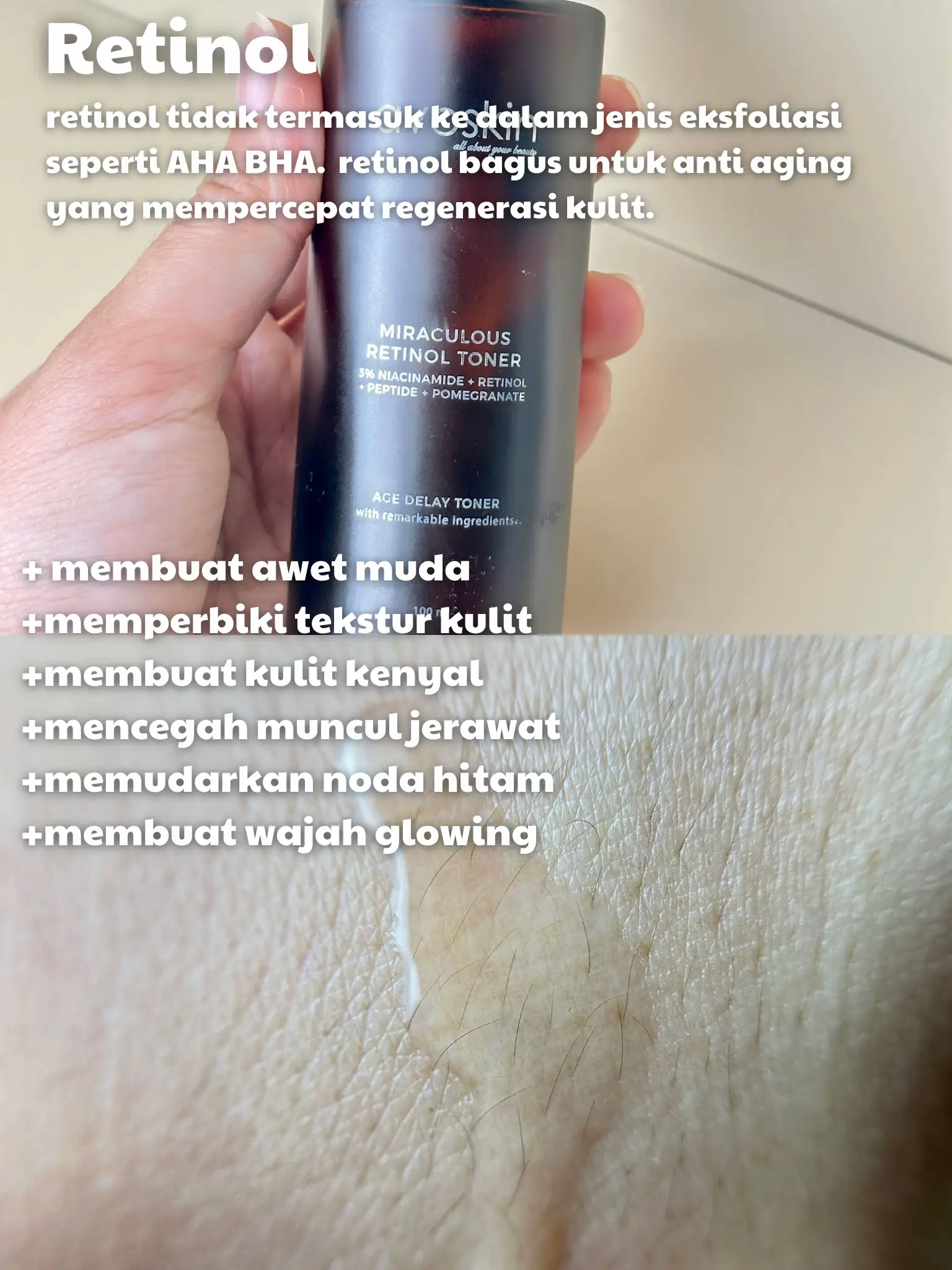 19 Ide Perbedaan Retinol Dan Exfoliasi Teratas Di 2024