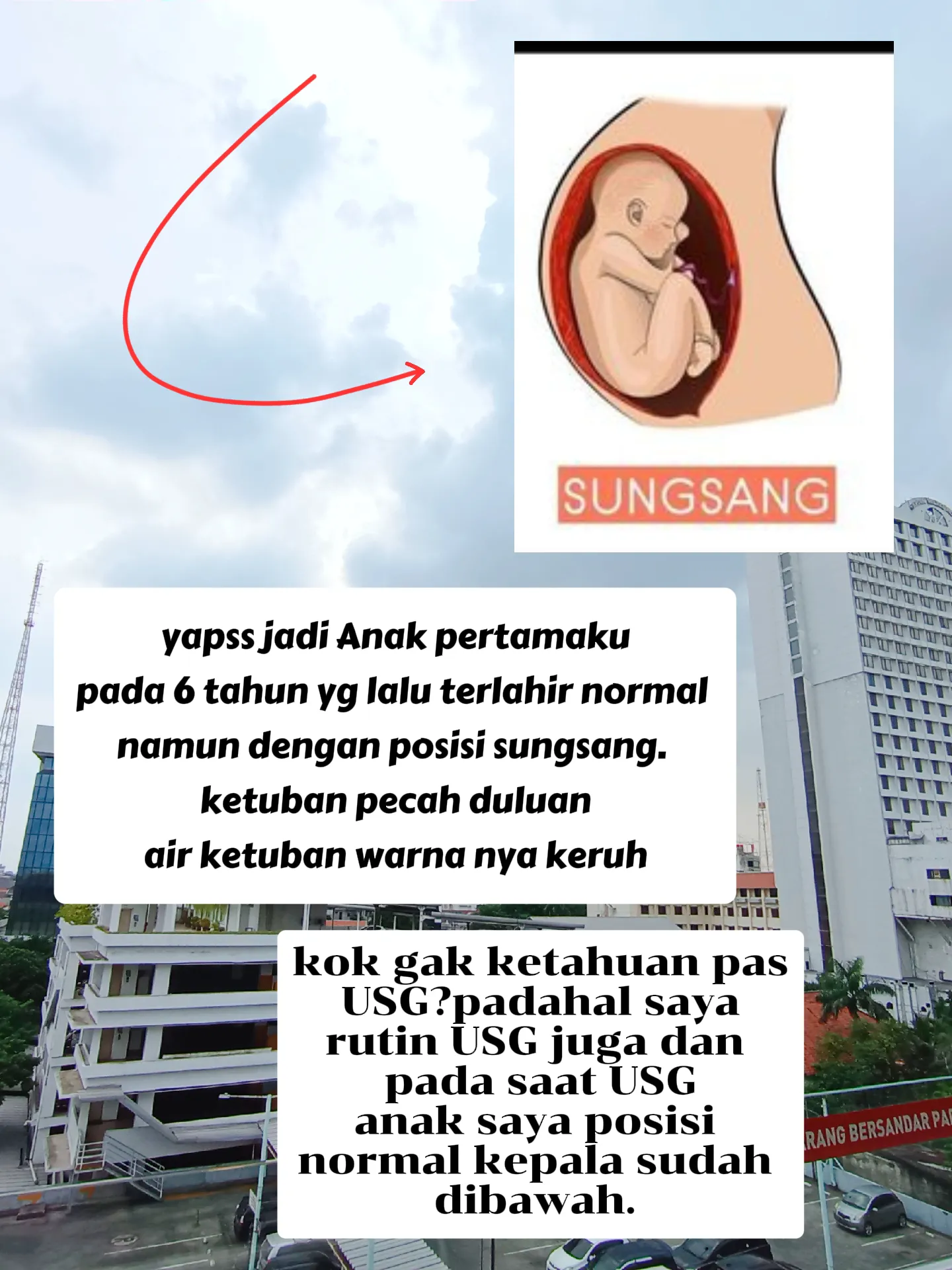 LAHIRAN NORMAL DENGAN POSISI BAYI SUNGSANG | Galeri diposting oleh ...