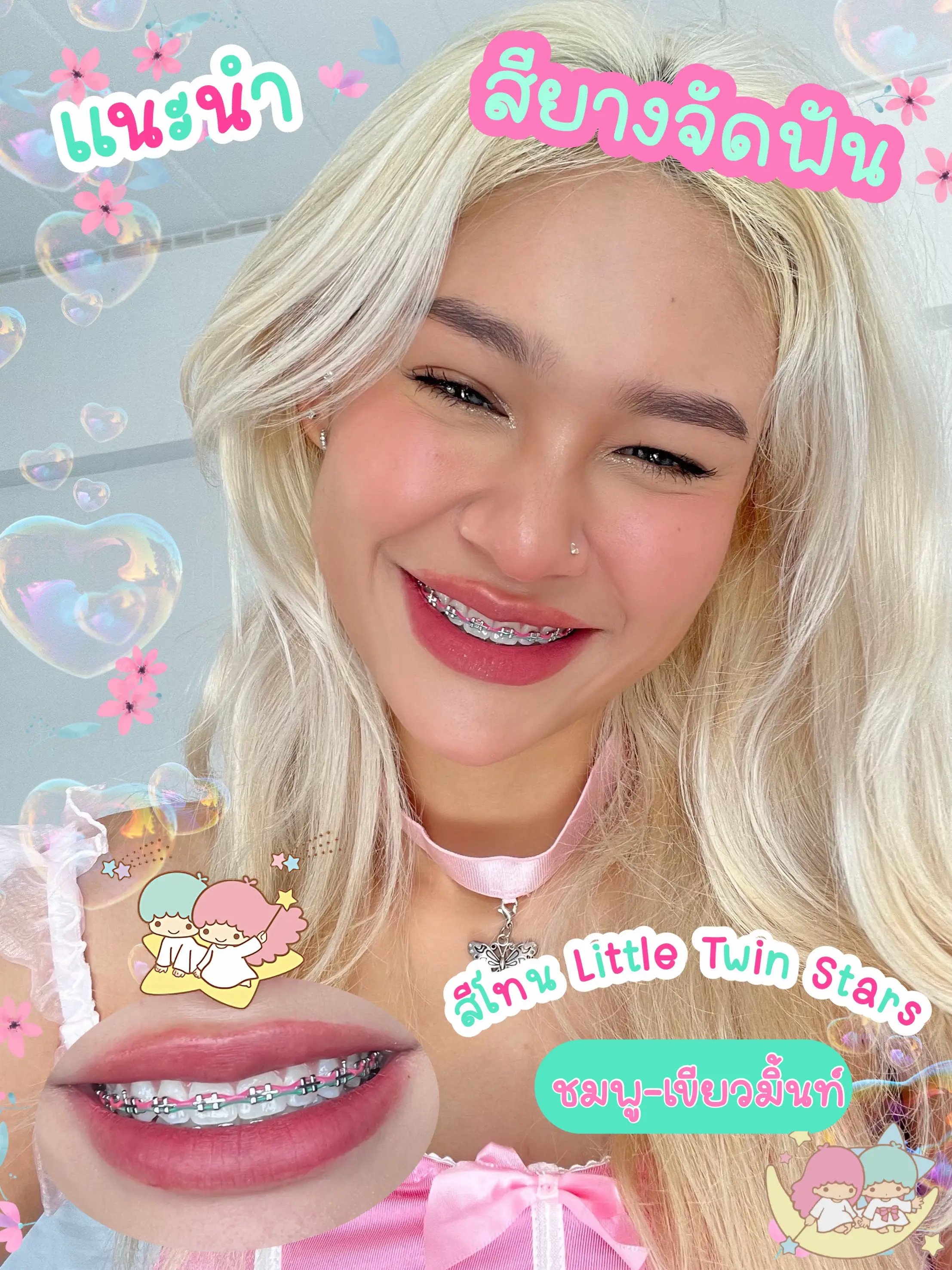 🍬แนะนำสียางจัดฟัน สีน้อง Little Twin Stars🎀 | แกลเลอรีที่โพสต์โดย Helen ...