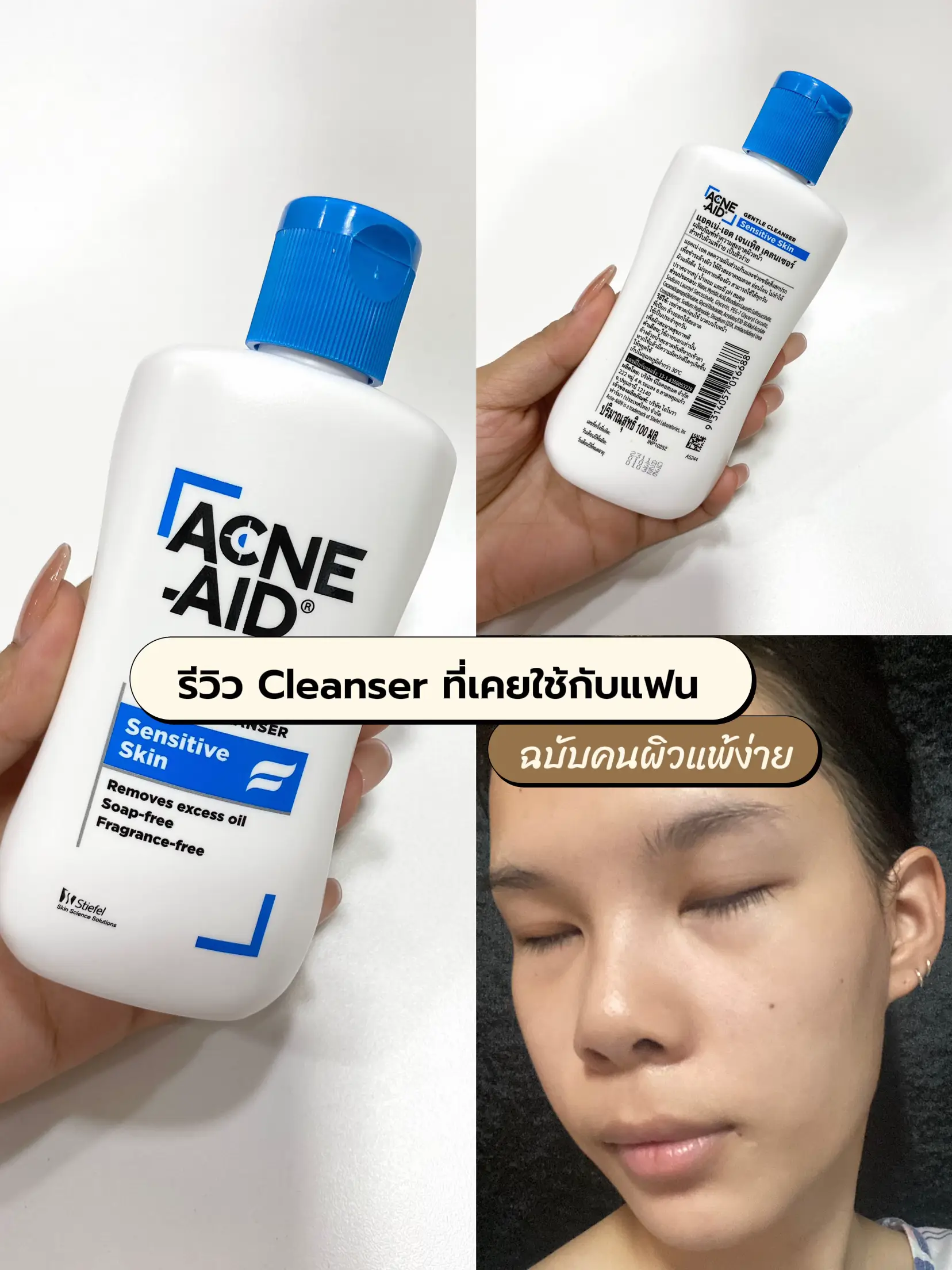 Acne aid deals gentle cleanser