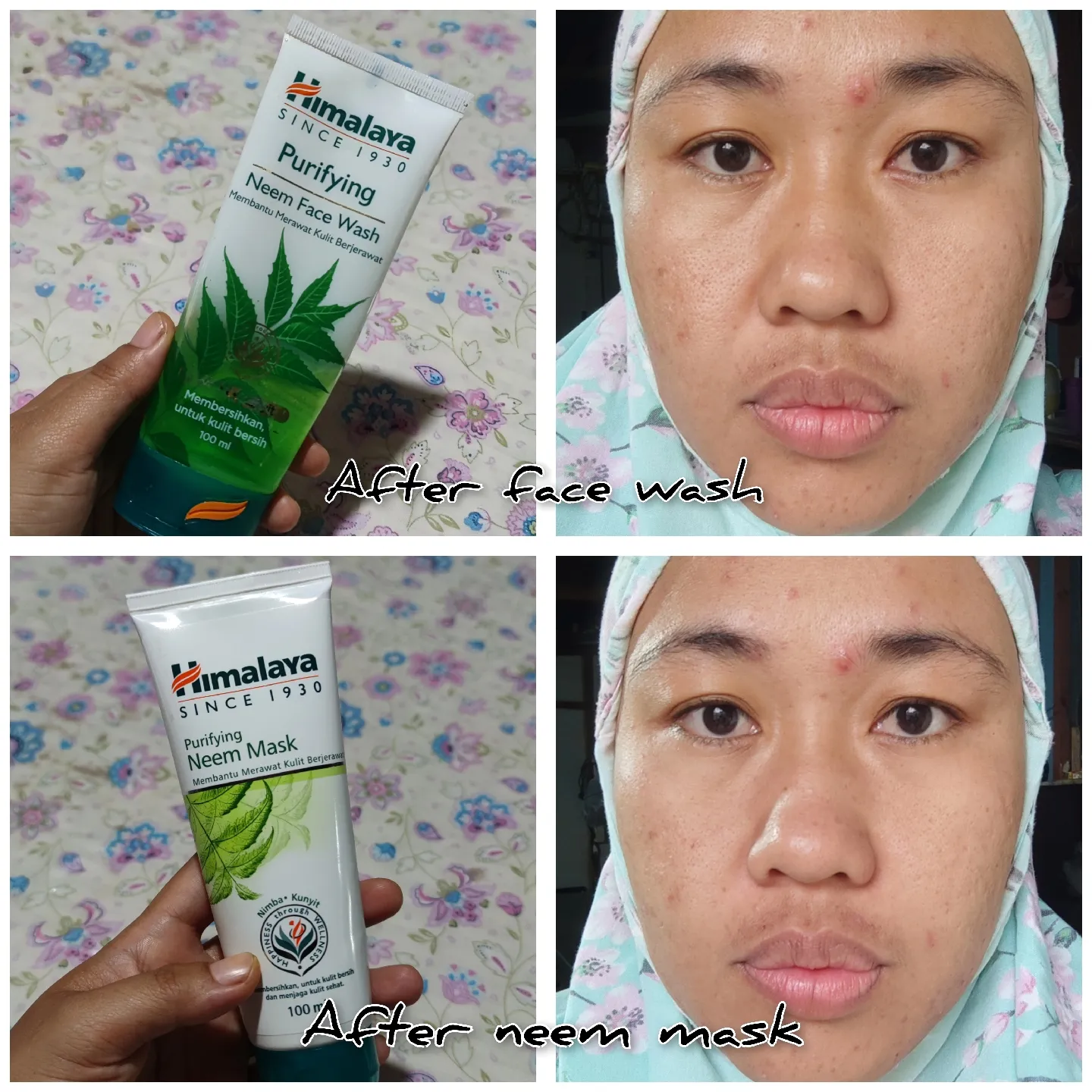 Review jujur produk Himalaya Gallery posted by Adek DM Ayu Lemon8