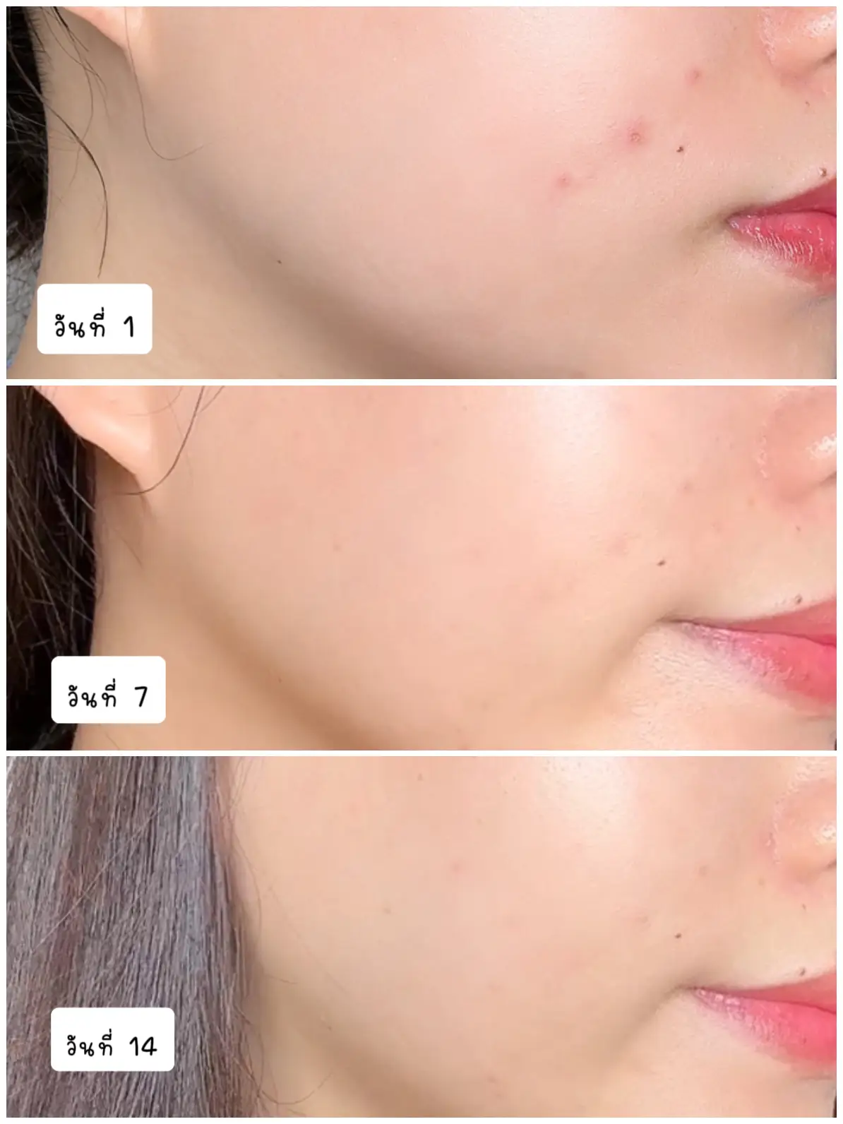 วิตามินซีเซรั่ม ญี่ปุ่น - การค้นหาใน Lemon8