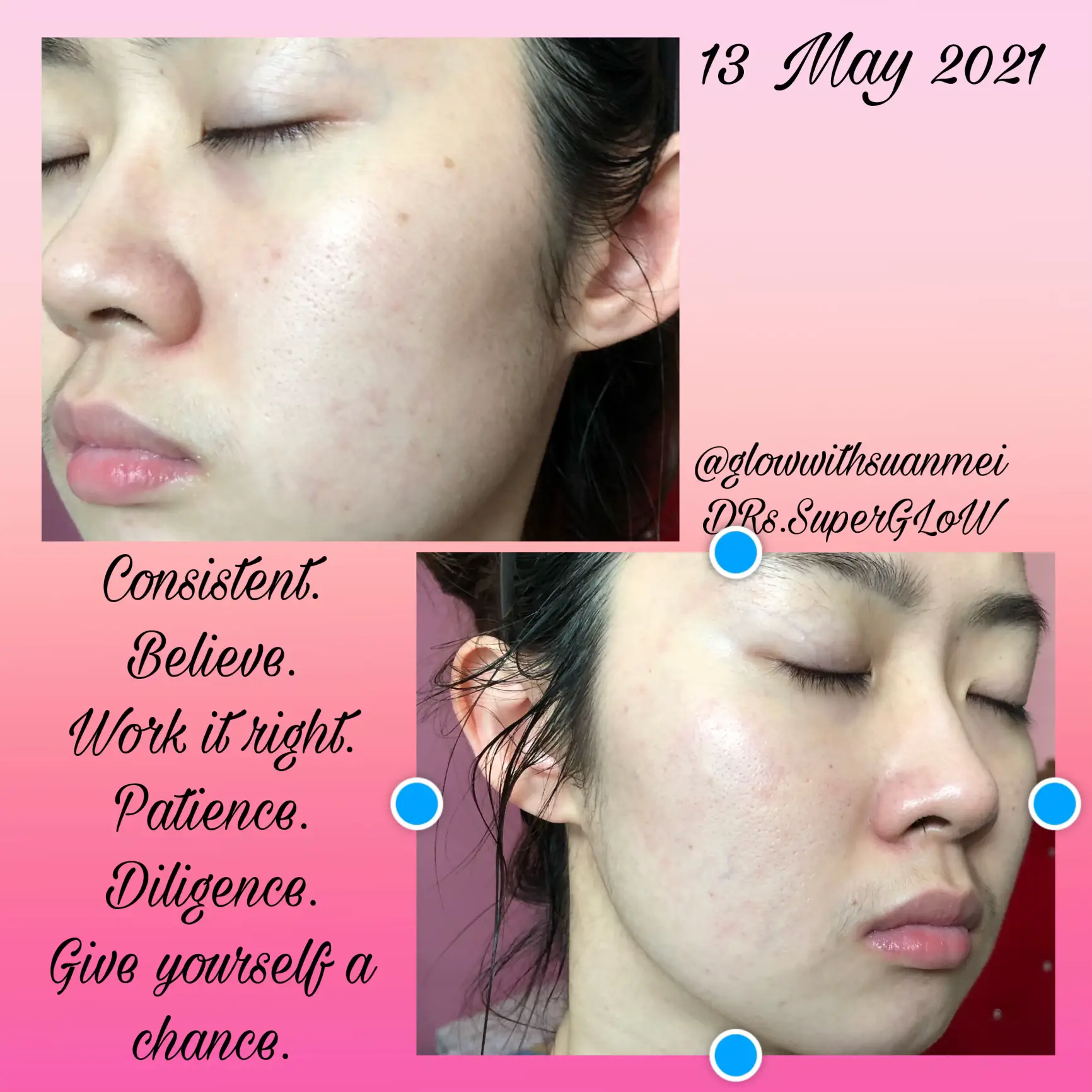 A skincare that I stick with 3 years! acne & clogs's images(8)
