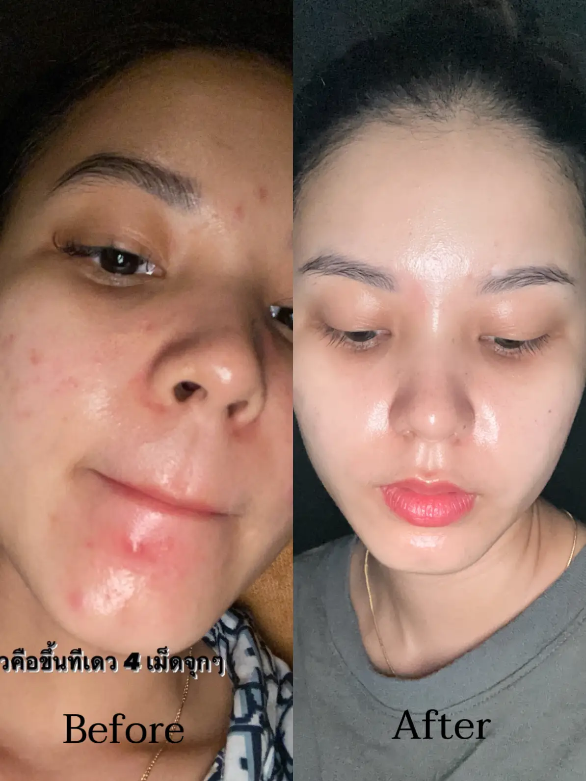 retinol cerave - การค้นหาใน Lemon8