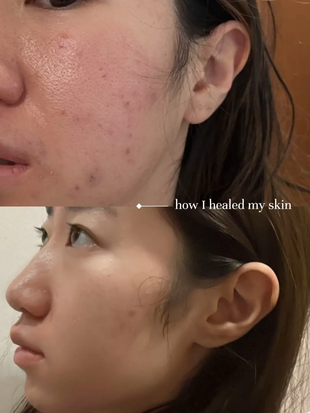 how I healed my damaged skin barrier💡's images(0)
