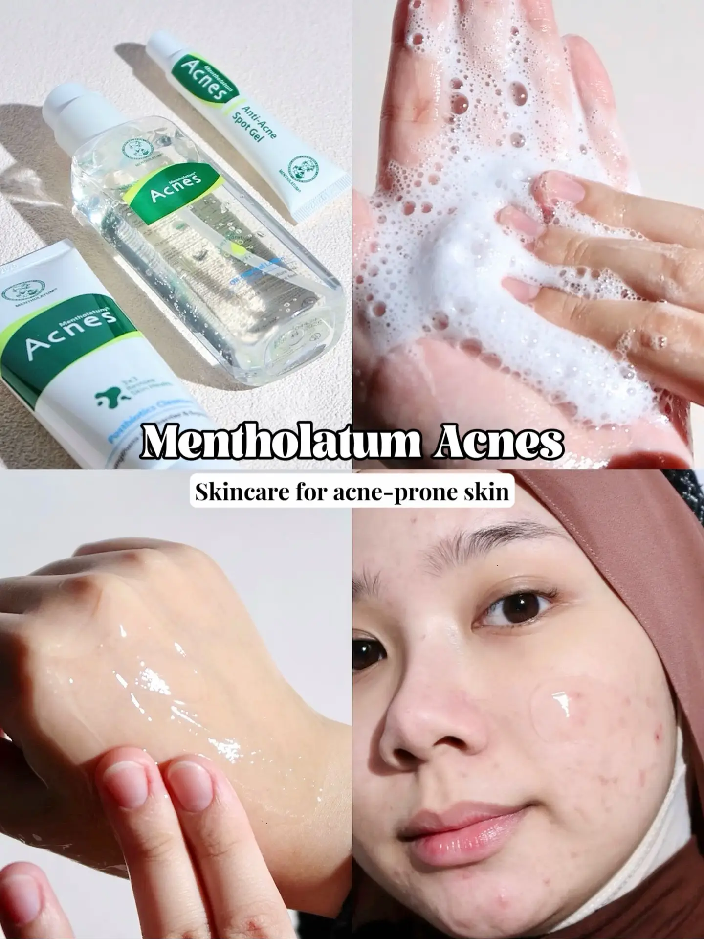 Skincare routine for acne prone skin✓ | Video published by Syafflyn | Lemon8