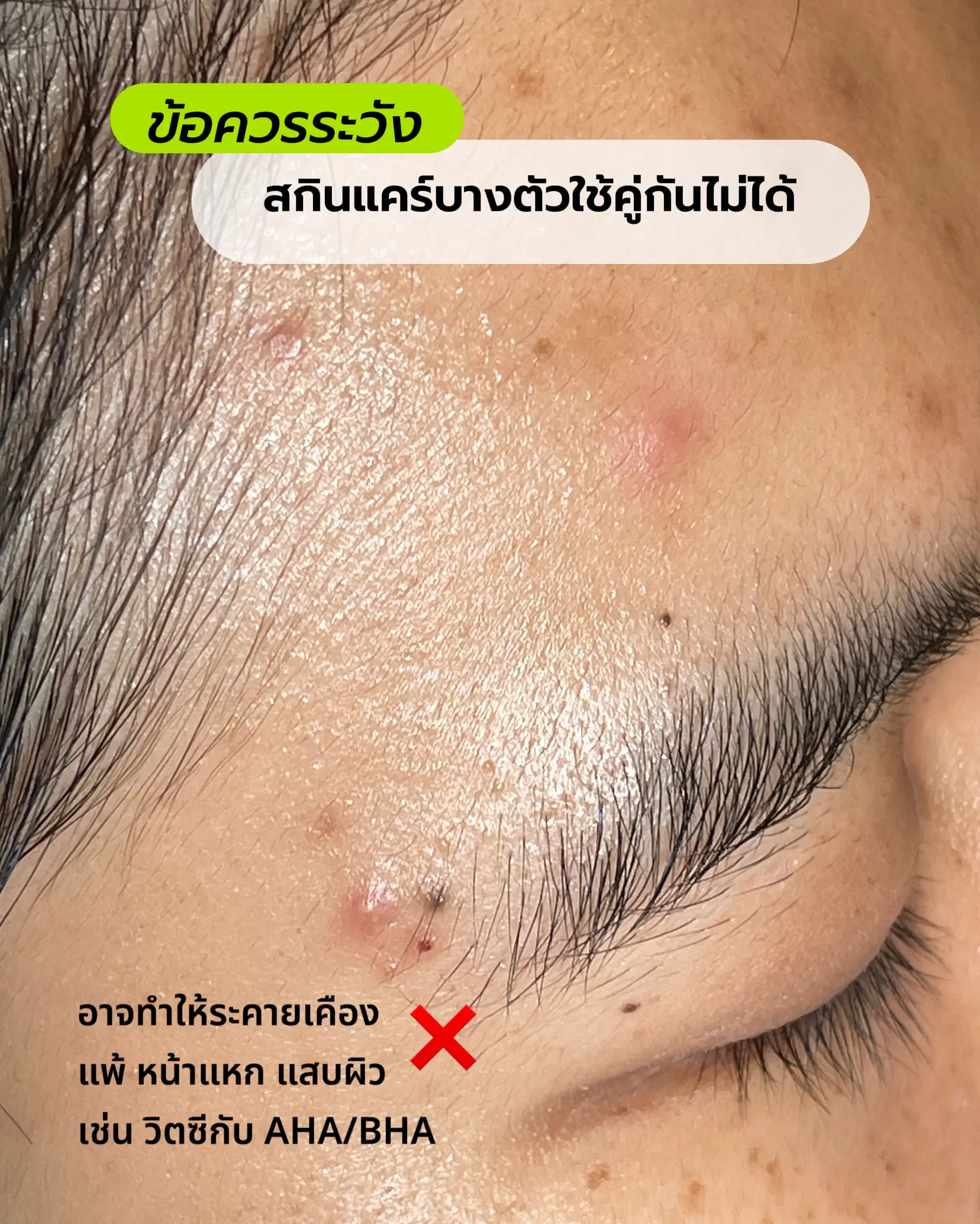 เปปไทด์ ห้ามทากับอะไร | วิดีโอที่เผยแพร่โดย เป้อยากบอก | Lemon8