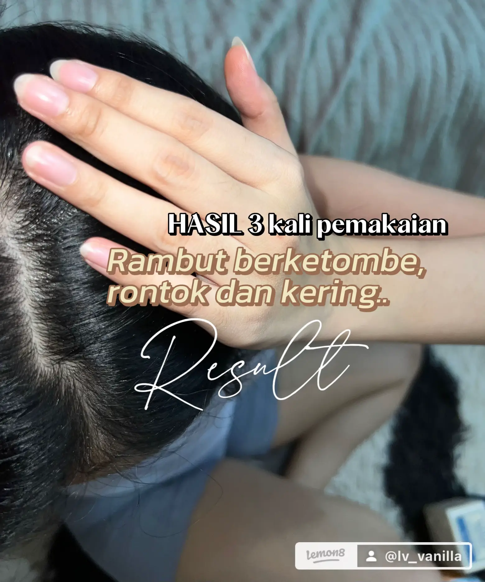 Anti Ketombe Dan Rambut Rontok | Galeri diposting oleh meyuliantii98 ...