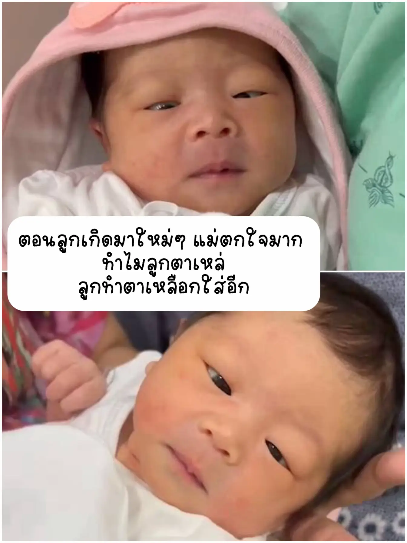 Newborn Child strabismus New Mother Don t Panic Gallery Posted newborn-child-strabismus-new-mother-don-t-panic-gallery-posted