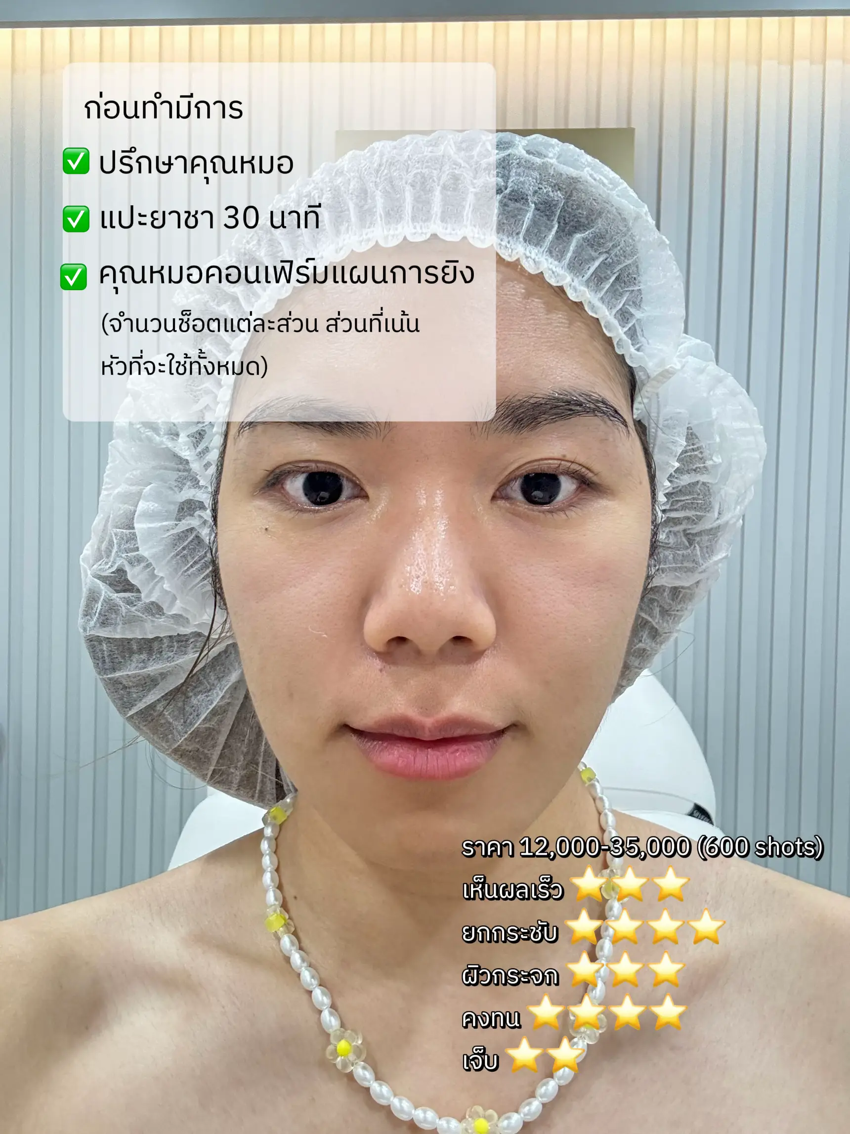 เบยร ชาง ยก ลงBlog Posts - 31hlwg8