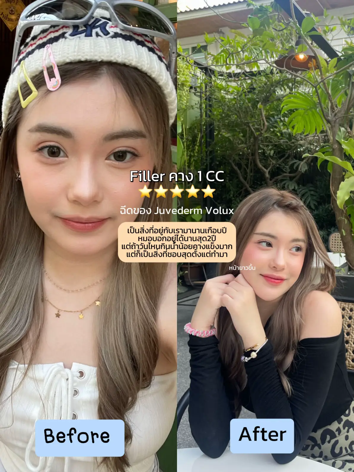 Rate หัตถการที่เคยทำมาทั้งหมด ⭐️🩸💪🏿 | แกลเลอรีที่โพสต์โดย Jinny :p | Lemon8