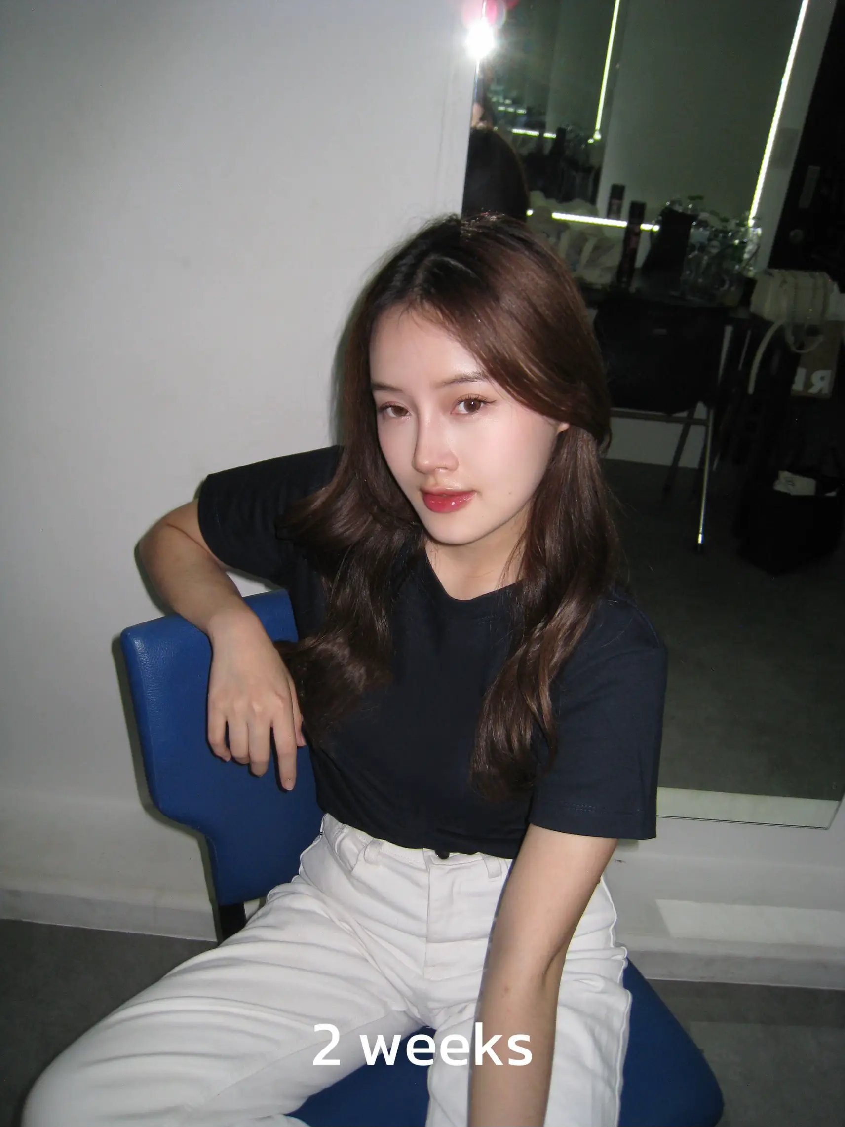 ทำจมูกแล้วหน้าเปลี่ยนจริงมั้ย | แกลเลอรีที่โพสต์โดย chanann🦋 | Lemon8