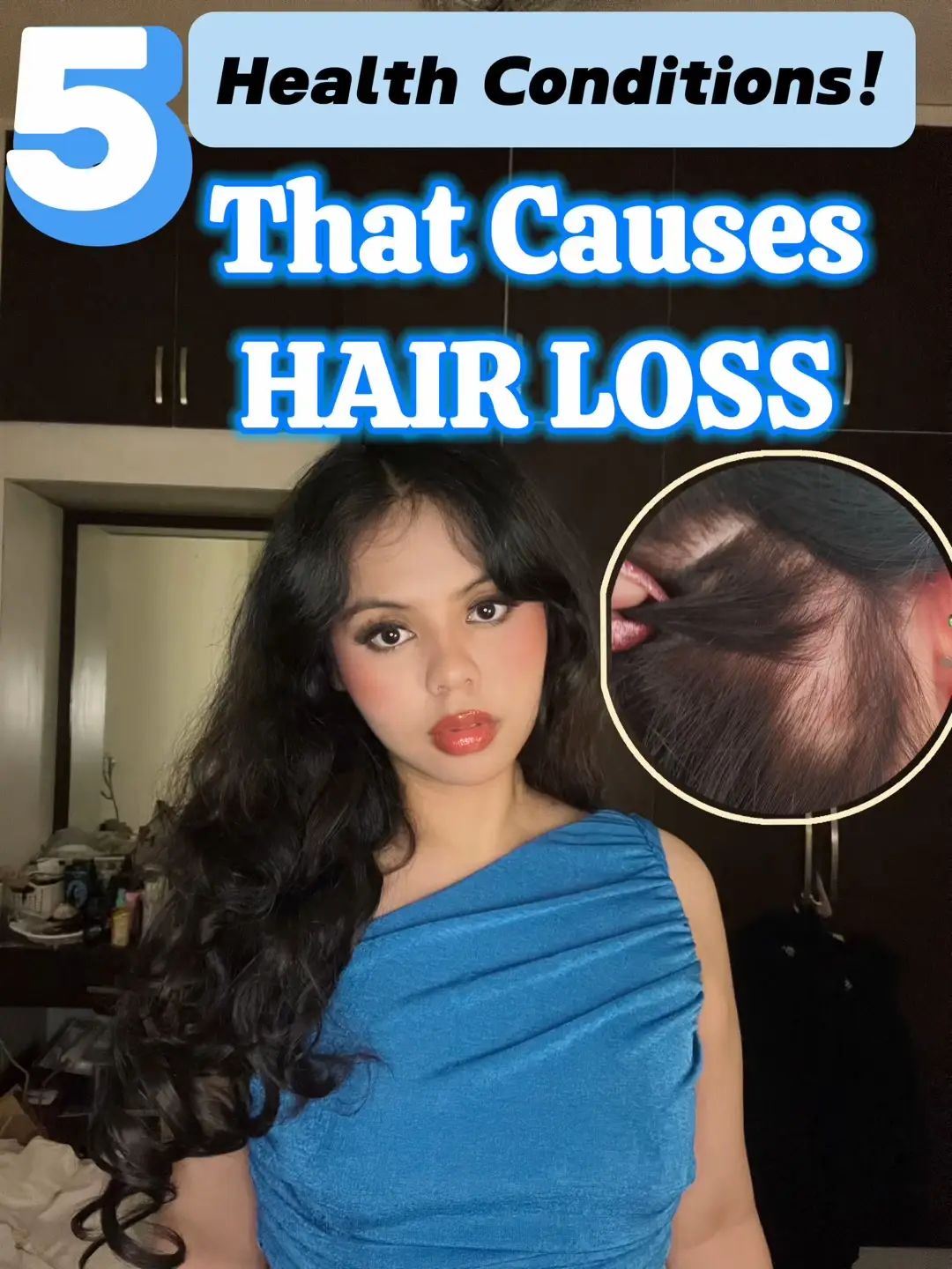 5 Health Conditions That Causes Hair Loss/Fall