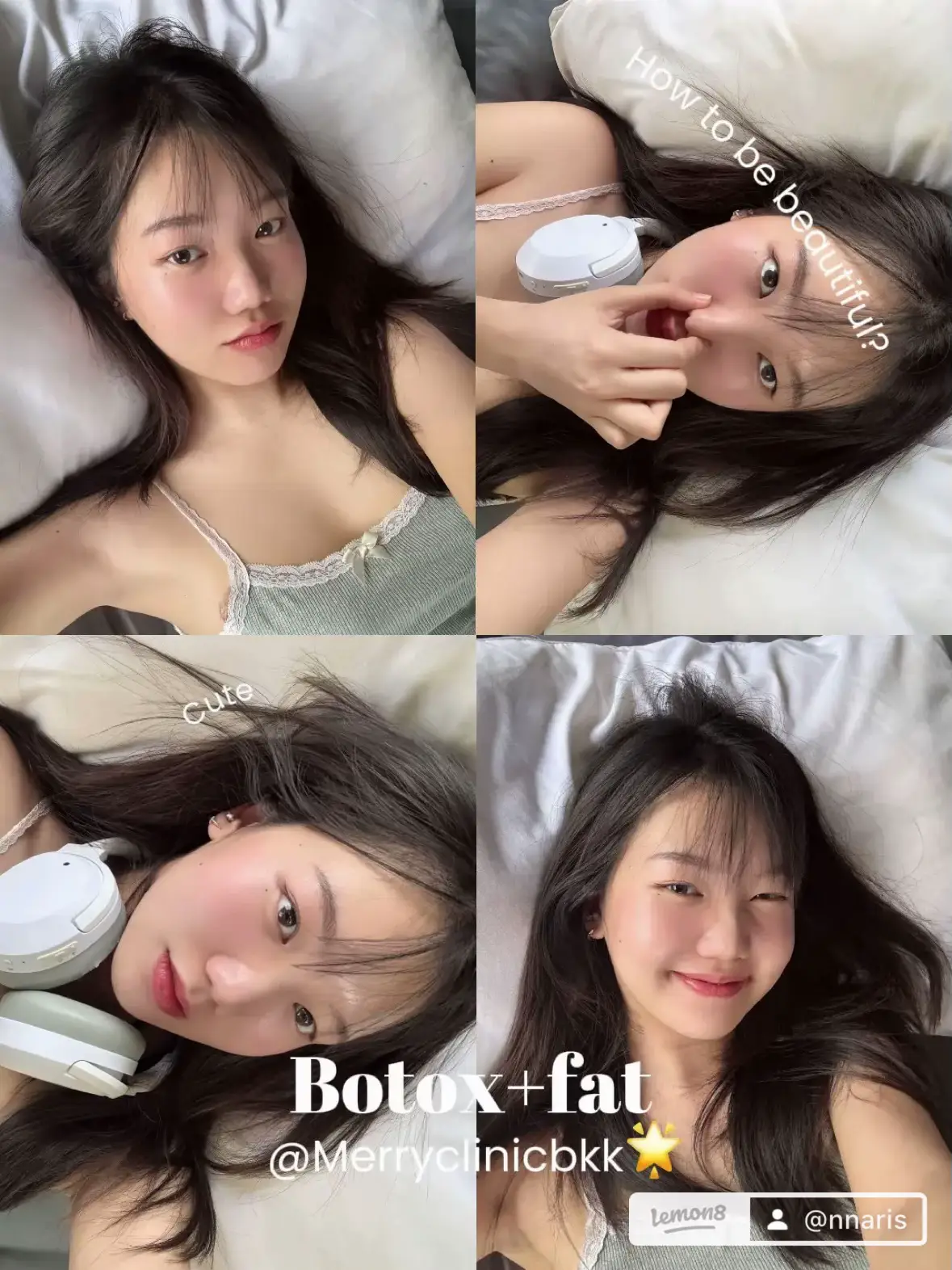 รีวิวเรียลๆ Fat+Botox+Hifu 📍ธรรมดาคลินิก | แกลเลอรีที่โพสต์โดย ...