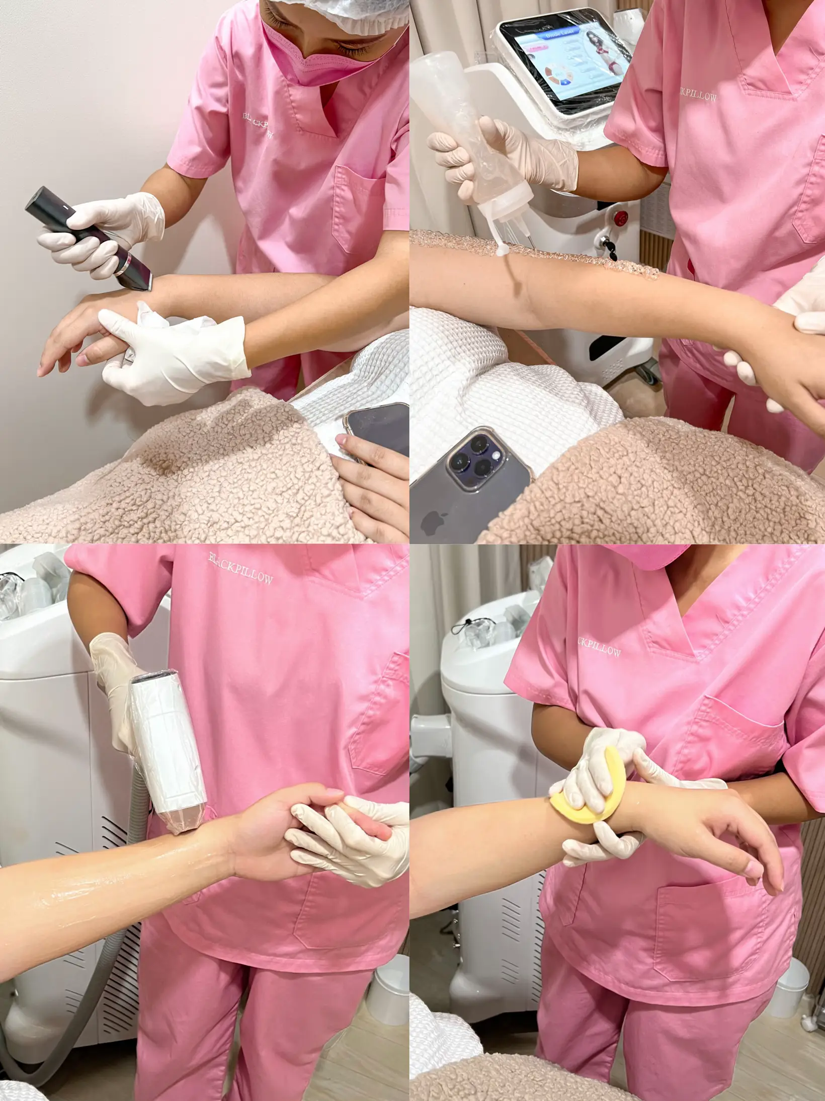 The First Arm Hair Laser Review Changed The Monkey To The Barrier the-first-arm-hair-laser-review-changed-the-monkey-to-the-barrier