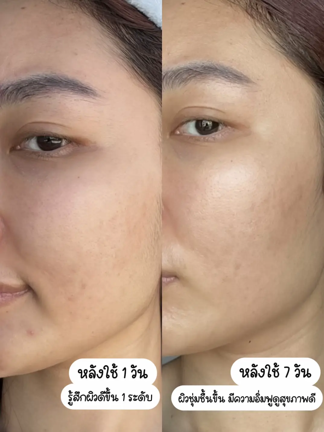 กู้ผิวหน้าบอบบางหลังทำเลเซอร์ด้วยสกินแคร์ฟื้นฟูปราการผิว🚨 | แกลเลอรีที่ ...