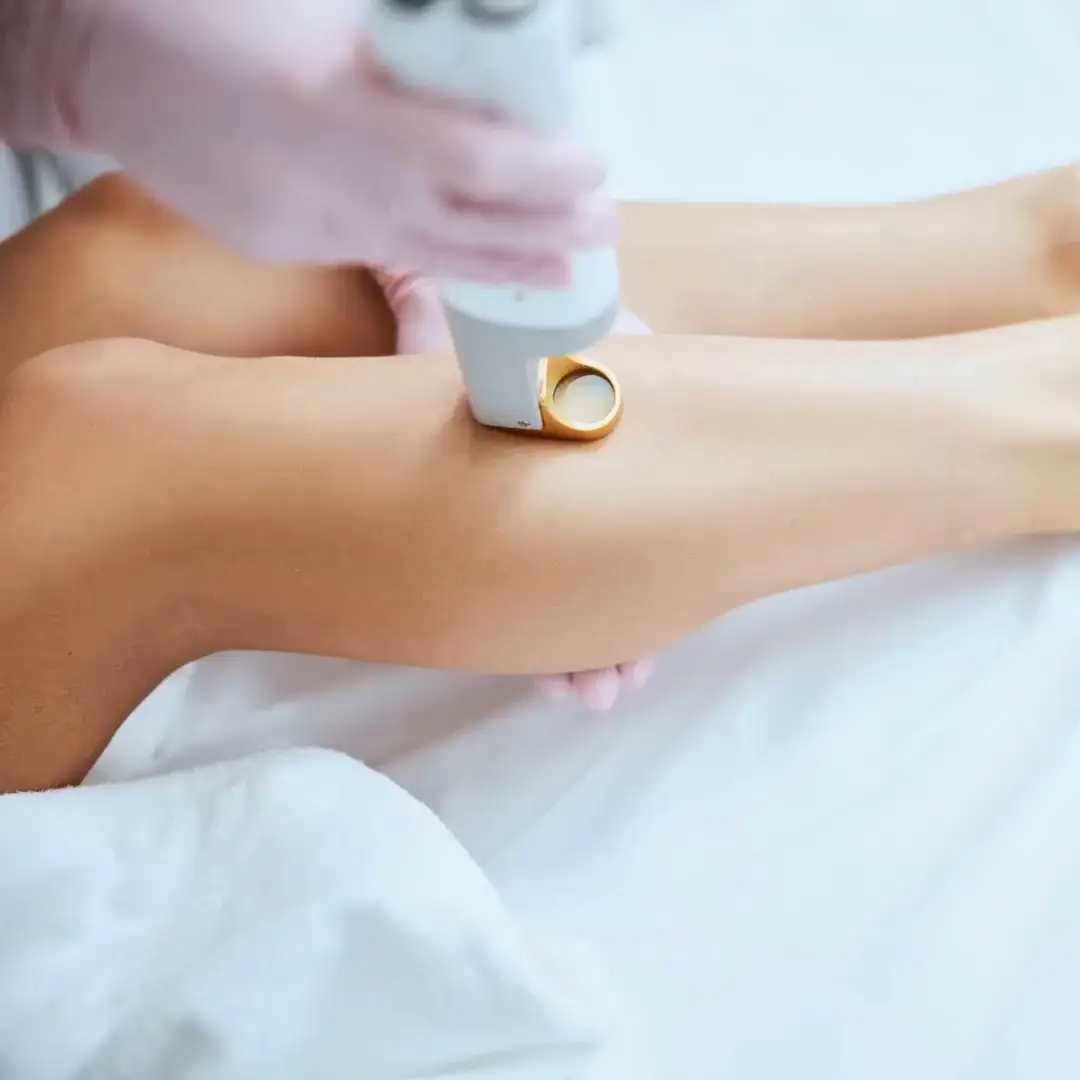 Unlock Confidence with Wellaholic’s Hair Removal's images