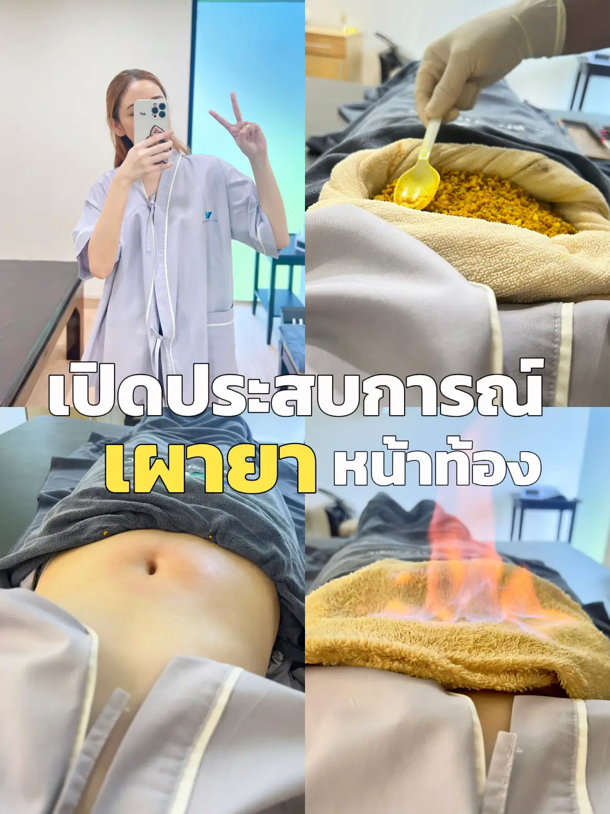 เปิดประสบการณ์เผายาหน้าท้องครั้งแรก เวิร์คมั้ย ช่วยอะไรบ้าง💡🔥 แกลเลอรีที่โพสต์โดย Pipimwila