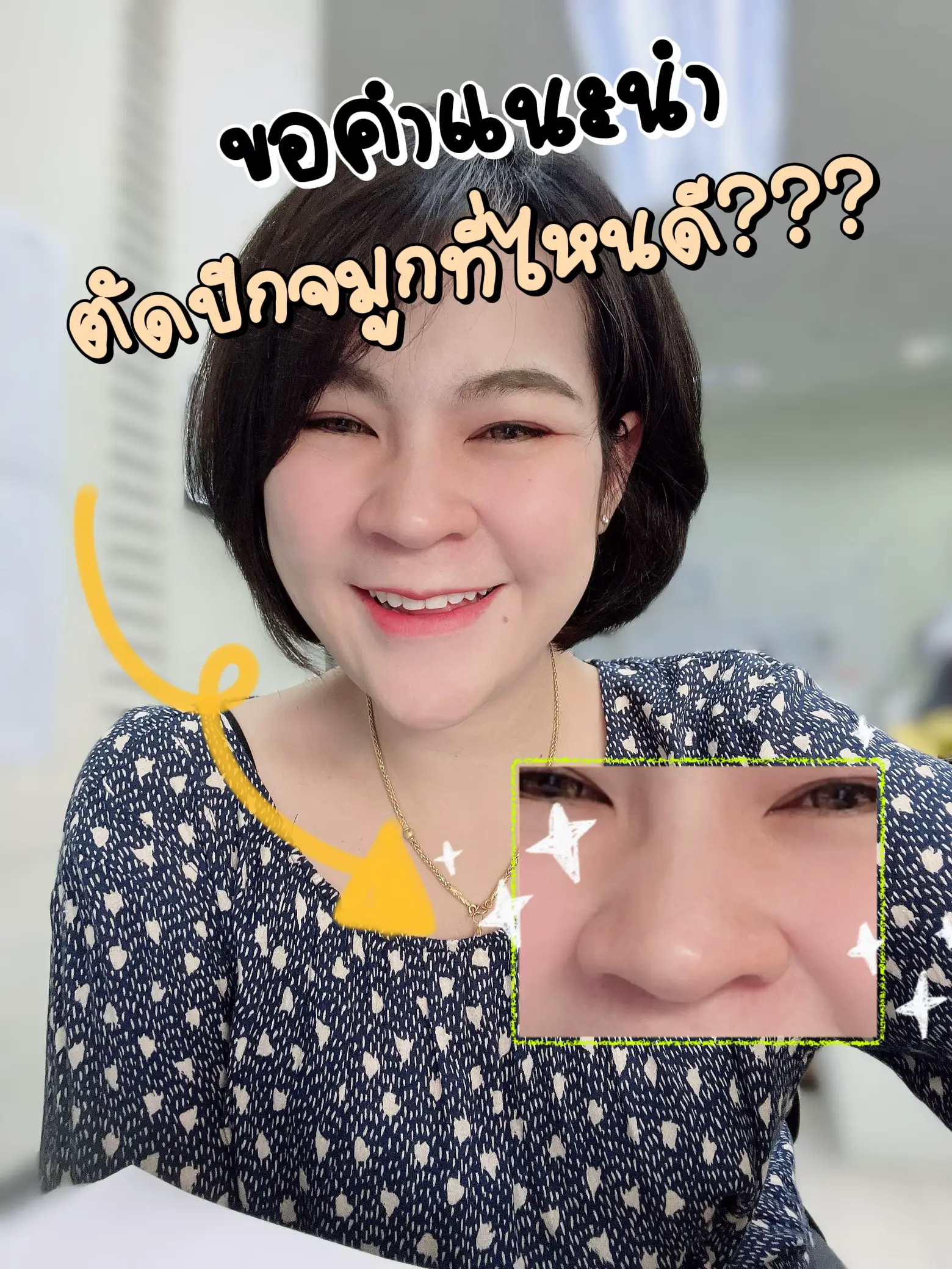 ขอคลีนิคเด็ดๆ ตัดปีกจมูกสวยๆครั้งเดียวจบ⭕️ | แกลเลอรีที่โพสต์โดย Ma