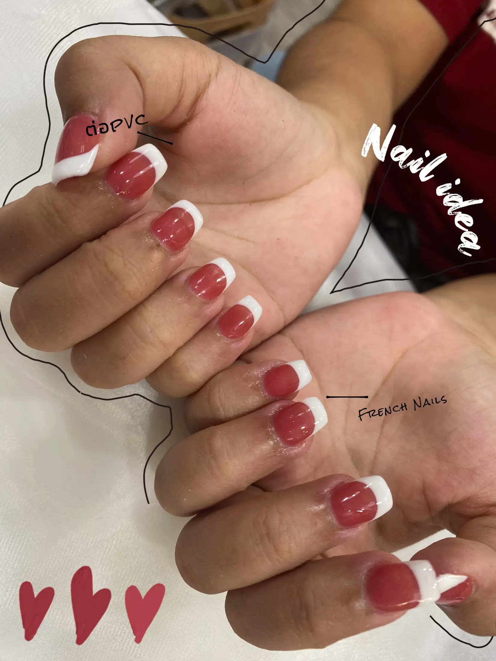 BITTEN NAILS GET ACRYLICS 