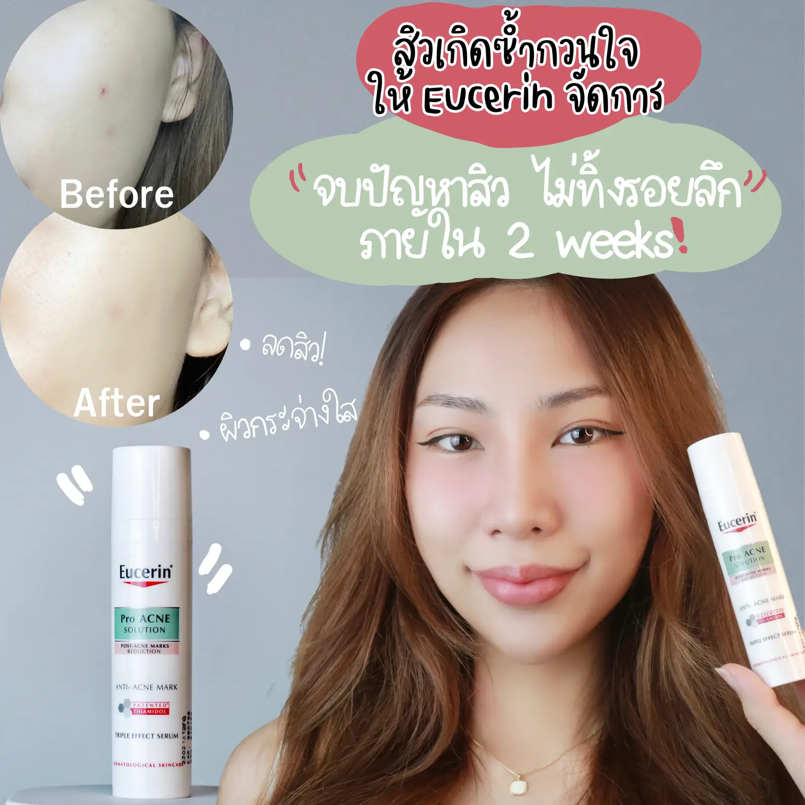 post acne marks treatment eucerin